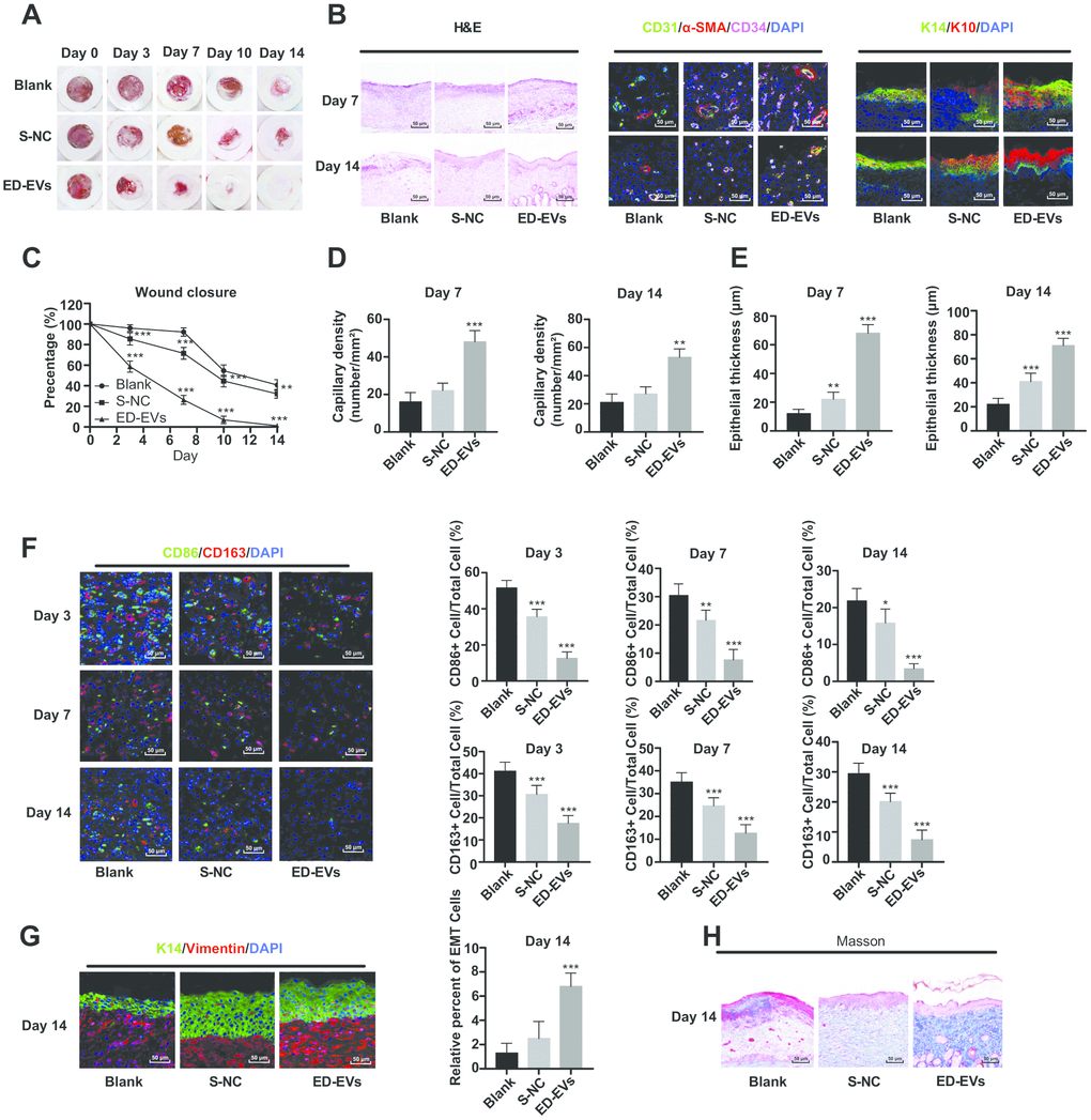 Plasma ED-EVs promote skin wound healing in diabetic mice. (A and C) The wound area of diabetic mice was measured on the 0, 3, 7, 10 and 14 days after skin wound modeling (n = 6). On the 3rd, 7th and 14th day after skin wound modeling, the pathological changes (B, H), vascular markers (B, D), re-epithelialization (E), macrophage infiltration and EMT (F, G) and collagen deposition (F) in the skin of diabetic mice were detected by HE staining (n = 3), immunofluorescence (n = 6) and Masson staining (n = 3). Compared with the blank group, *p p p C) were analyzed by two-way ANOVA, and data in panels (D–G) were analyzed by one-way ANOVA, followed by Tukey's multiple comparisons test. Repetitions = 3.