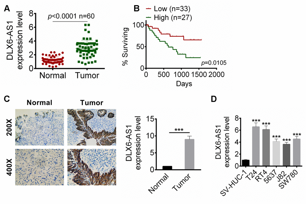 DLX6-AS1 was up-regulated in BC tissues and cell lines. (A) The DLX6-AS1 expression in 60 cases of BC tissues and adjacent normal tissues were determined by qRT-PCR. (B) The relationship of 5 year survival rate of the BC patients with high (n=27) or low (n=33) DLX6-AS1 expression were analyzed by Kaplan-Meier’s method and the log-rank test. (C) The expression of DLX6-AS1 in BC tissues and normal tissues was determined by ISH assay. (D) The mRNA expression level of DLX6-AS1 in a human bladder epithelium immortalized cell line (SV-HUC-1) and five BC cell lines (T24, RT4, 5637, J82, and SW780) was determined by qRT-PCR. The DLX6-AS1 was highly expressed in BC cells. Data were expressed as the mean ± SD. ***P 