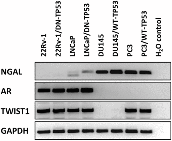 RT-PCR analysis of NGAL, AR, TWIST1 and GAPDH mRNAs in prostate cancer cell lines containing or lacking functional TP53. RT-PCR analysis was performed on 22Rv-1, 22Rv-1+DN-TP53, LNCaP, LNCaP + DN-TP53, DU145, DU145 + WT-TP53, PC3 and PC3 + WT-TP53 cells with oligonucleotides specific for NGAL, AR, TWIST1 and GAPDH. These genes are differentially expressed in the four prostate cancer cell lines.