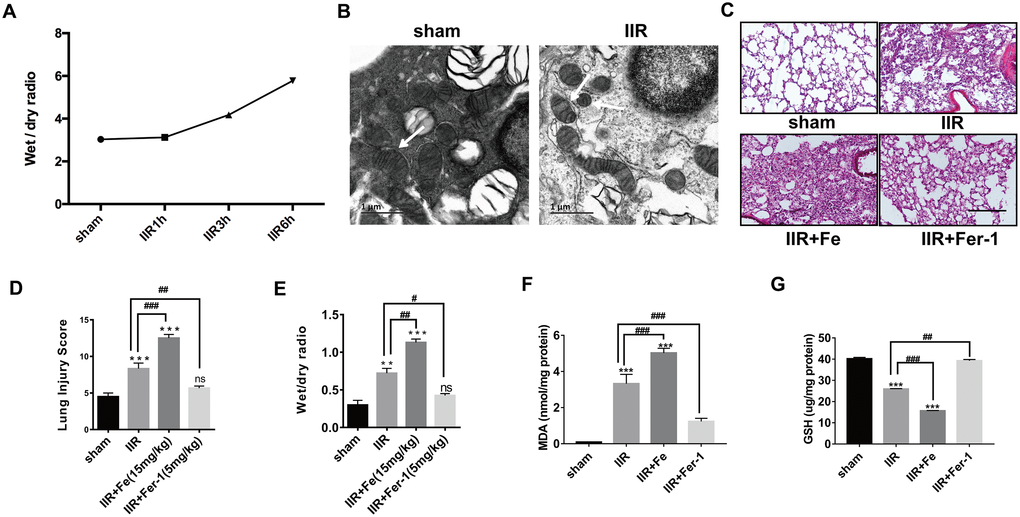 IIR induces ferroptosis in type II alveolar epithelial cells. (A) The degree of pulmonary oedema continued to increase with the extension of reperfusion time. (B) Representative transmission electron micrographs of the ultrastructure of lung tissues. Scale bars: 1 μm. (C) HE staining of the lung tissues of mice following IIR, IIR + Fe, and IIR + Fer-1. Scale bars: 200 μm. (D) The lung pathological damage score showed an addition and reduction after Fe and Fer-1 administration, respectively. (E) The wet to dry ratio of the lung tissue shown in each group. (F) The level of lipid peroxide MDA in each group. (G) The GSH level in each group. The error bars represent the standard error from three replicates. Data are presented as the mean ± SEM. *P P P 