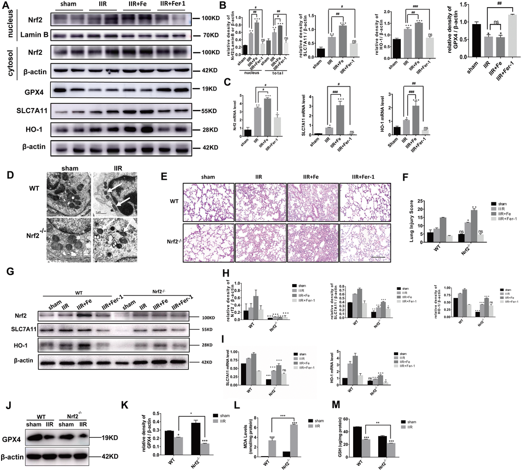 Nrf2 regulates SLC7A11 and HO-1 to inhibit ferroptosis and protect against IIR-ALI. (A) Western blot analysis of Nrf2, HO-1, SLC7A11, and GPX4 expression in the lung tissues of each group. (B) The representative quantification of these proteins. (C) Relative mRNA expression of Nrf2, SLC7A11, and HO-1 in each group. (D) Representative transmission electron micrographs of the ultrastructure of the lung tissues. Scale bars: 1 μm. (E) Representative HE-stained lung sections. Morphology was examined using light microscopy. Scale bars: 200 μm. (F) Pathological scores were assigned by an experienced pathologist. (G) Western blot analysis of Nrf2, SLC7A11, and HO-1 expression in the lung tissues of each group. (H) The representative quantification of these proteins. (I) Relative mRNA expression of SLC7A11 and HO-1 in each group. (J) Western blot analysis of GPX4 expression in each group. (K) The representative quantification of GPX4 protein. (L) The lipid peroxide MDA level in each group. (M) The GSH level in each group. The error bars represent the standard error from three replicates. Data are presented as the mean ± SEM. *P P P 