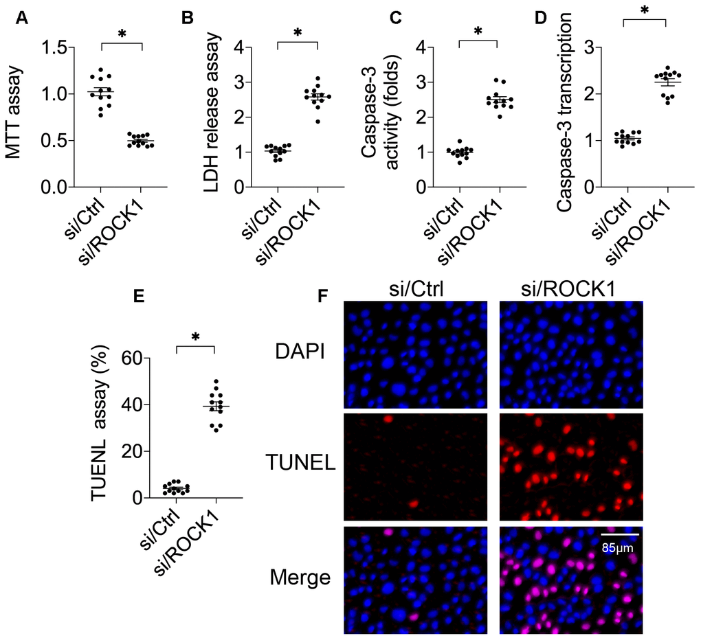 ROCK1 regulates A549 cell viability. (A) MTT assay for A549 cells. A549 cells were transfected with siRNA against ROCK1 (si/ROCK1) or control siRNA (si/Ctrl). (B) An LDH release assay was used to measure LDH levels in the medium of A549 cells transfected with siRNA against ROCK1 (si/ROCK1) or control siRNA (si/Ctrl). (C) ELISA was used to analyze Caspase-3 activity in response to si/ROCK1 or si/Ctrl transfection. (D) A qPCR assay was used to measure Caspase-3 transcription. (E, F) TUNEL staining was used to measure numbers of apoptotic cells in response to si/ROCK1 or si/Ctrl transfection. *p