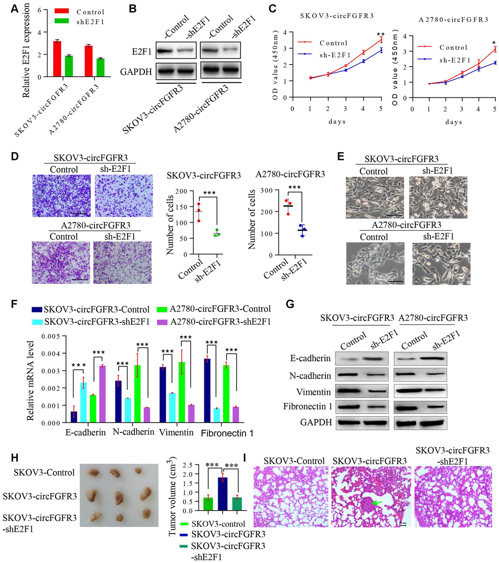 The knockdown of E2F1 suppresses circFGFR3-induced OC EMT and progression. (A). shRNA interference was used to modify the E2F1 mRNA expression in OC cells. (B) Knockdown of E2F1 attenuated circFGFR3-induced upregulation of E2F1 expression in OC cells; (C) and (D) CCK8 assays were used to measure OC cell viability and Transwell assays were used to measure OC cell migration. Data are represented as the mean ± SD, n=3, *PE) The cellular morphology of OC cells with circFGFR3 overexpression and different expression levels of E2F1 is shown, bar=200 μm; (F and G) Cells expressing high levels of circFGFR3 showed an increase in the epithelial marker E-cadherin, and decreases in the mesenchymal markers vimentin, fibronectin 1 and N-cadherin when E2F1 was knocked down. (H) Representative images of the tumors from each group (n = 3 mice/group). (I) Representative images of the lung to show the metastasis or no metastasis from each group (bar=50nm).