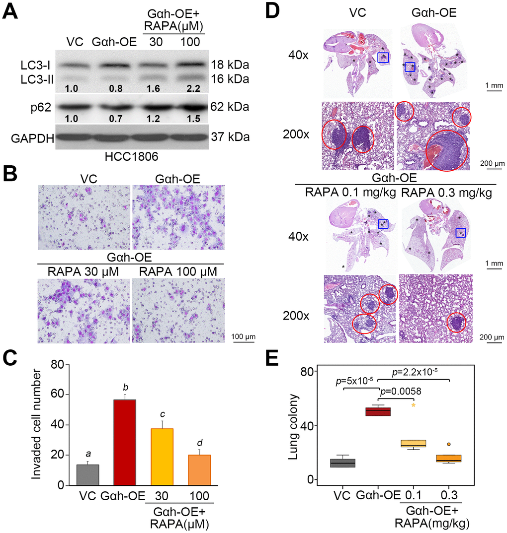 The inhibition of mTORC1 activity by rapamycin restores autophagy function but compromises the cellular invasion and lung metastatic abilities of Gαh-overexpressing HCC1806 cells. (A) Results from the Western blot analysis of the LC3-I/II, p62 and GAPDH proteins derived from HCC1806 cells without (VC) or overexpression Gαh (OE) in the absence or presence of the mTOR inhibitor rapamycin (RAPA) (30 or 100 μM). GAPDH was used as an internal control of protein loading. The protein intensities of representative blots from three independent experiments were normalized by GAPDH levels and presented as a ratio to the control group. (B–C) Giemsa staining (B) and cell number (C) for the invaded HCC1806 cell variants shown in A. Data obtained from three independent experiments are presented as the mean ± SEM. Letters indicate the significant differences at pD and E) H&E staining of lung tissues (D) and the number of lung tumor colonies (E) derived from mice (n=5) transplanted with the HCC1806 cell variants, shown in A, through tail vein injection for 4 weeks. Tumors are shown in red circles. Statistical significance was analyzed by nonparametric Mann-Whitney U test.