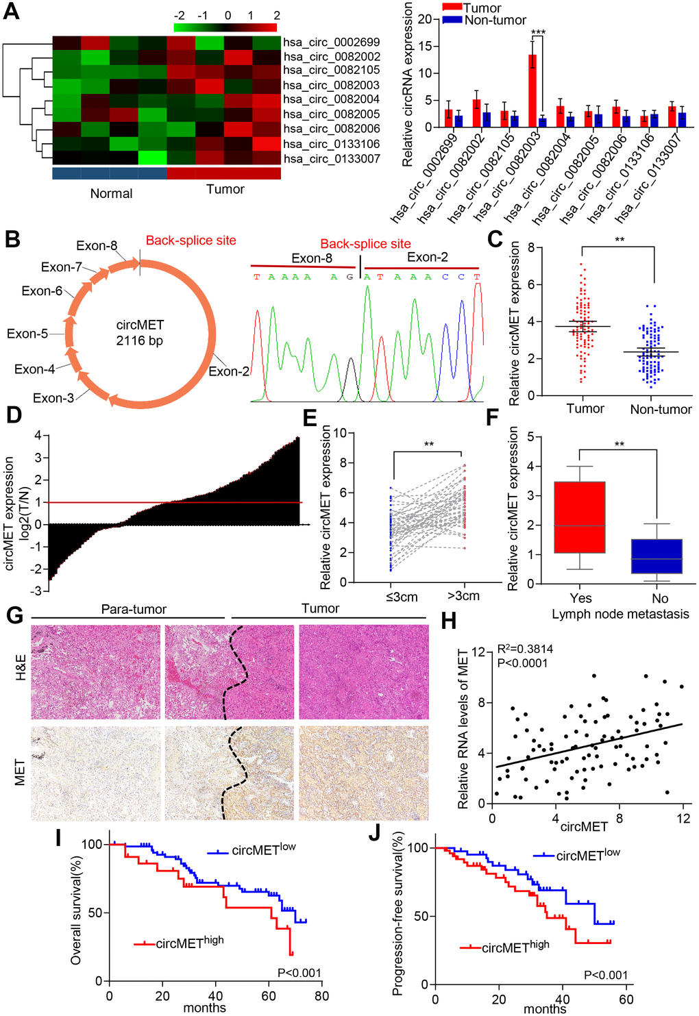 Identification of circMET in NSCLC tissues and its prognostic significance. (A) Clustered heat map shows the expression profiles of circRNAs derived from the MET gene in four paired NSCLC and adjacent nontumor tissues by qRT-PCR. (B) Scheme illustrating the production of circMET. (C) and (D) circMET was differentially expressed in 94 paired NSCLC tissues and adjacent normal tissues using real-time PCR analysis. (E) and (F) In total, 94 NSCLC patients were individually divided into low- and high-expression groups according to the clinicopathological characteristics, including tumor size or lymph node metastasis. (G) Representative images of serial sections stained with H&E and IHC for MET expression in NSCLC tissues. (H) A positive correlation between circMET and MET was observed in NSCLC tissues. (I) and (J) Prognostic analysis of circMET expression in 94 NSCLC patients. GAPDH was used as an internal control. *P 