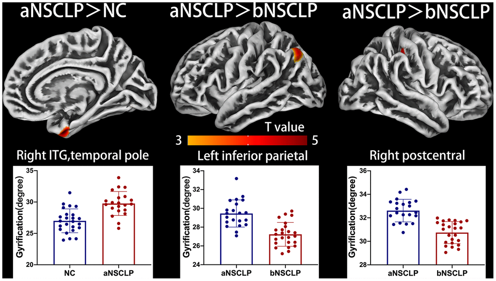 Altered gyrification between every pair in the three groups. Regions with intergroup differences are shown on lateral or medial views. Two-sample t-test for every pair in the three groups was used; statistical significance was P