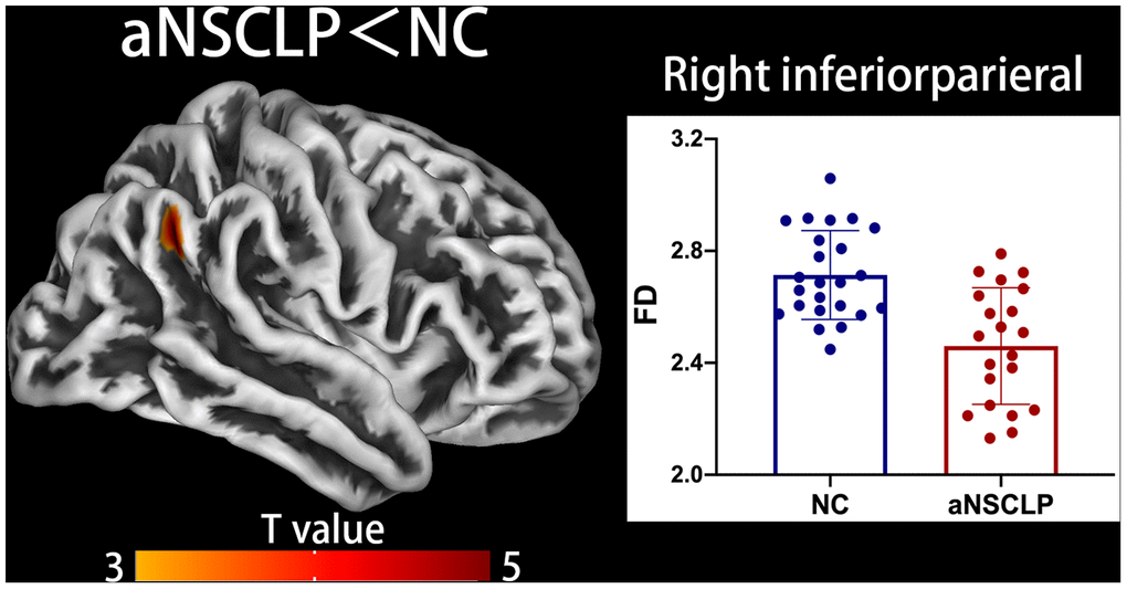 Decreased fractal dimension (FD) in aNSCLP compared with controls. Regions with intergroup differences are shown on lateral views. Two-sample t-test for every pair in the groups was used; statistical significance was P