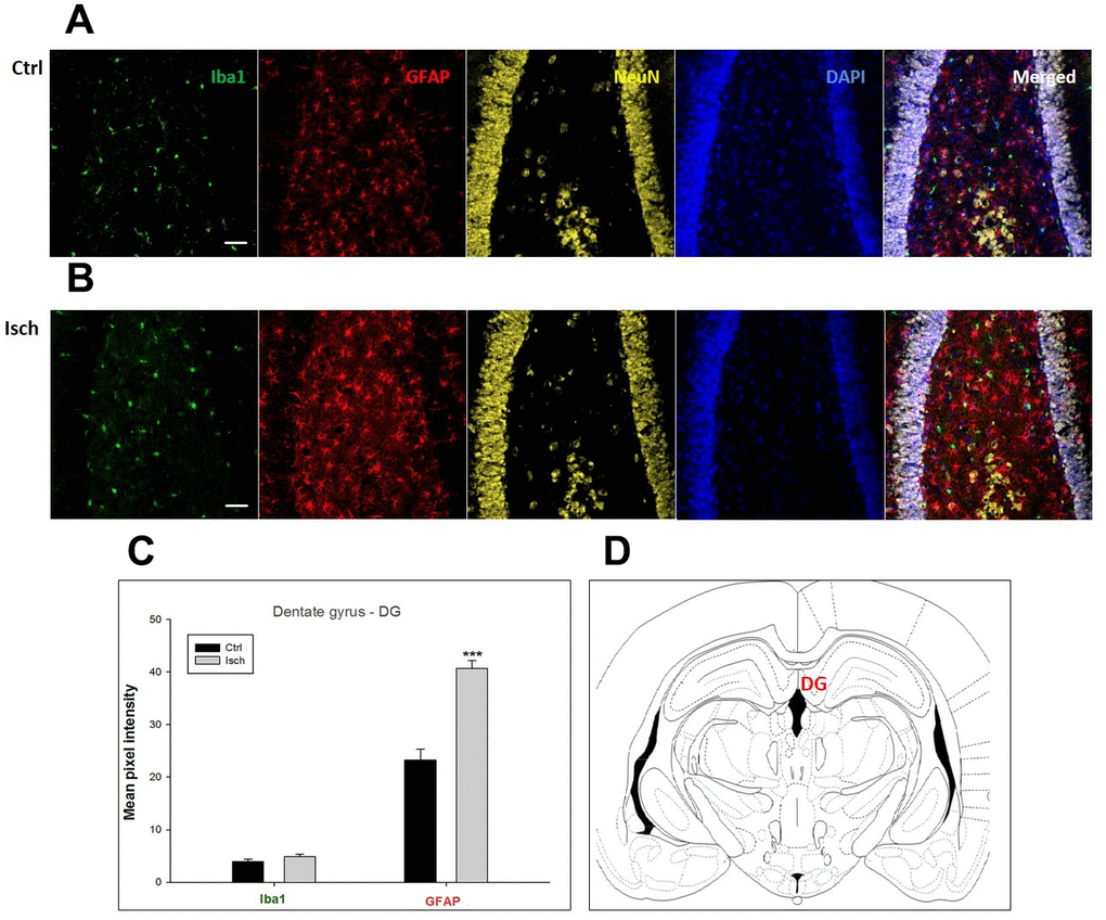 Confocal images of microglia and astrocytes in the post-ischemic dentate gyrus (DG) of the rat brain. Fourfold immunofluorescence labeling microglia with Iba1 (green), astrocytes with GFAP (red), neurons with NeuN (yellow), and nuclei with DAPI (blue). The scale bar represents 50 μm. (A) Ctrl – control brain, (B) Isch – post-ischemic brain, (C) Quantification of the mean pixel intensities for Iba1 and GFAP signals of post-ischemic vs. control animals with 2 years survival. Values are presented as mean ± SEM. *** pCtrl = 20, nIsch = 20, n = number of analyzed cross sections. (D) Schematic representation of the rat hippocampus level with DG region indicated.