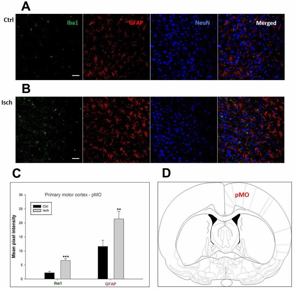 Confocal images of microglia and astrocytes in the post-ischemic primary motor cortex (pMO) of the rat brain. Triple immunofluorescence labeling microglia with Iba1 (green), astrocytes with GFAP (red), and neurons with NeuN (blue). The scale bar represents 50 μm. (A) Ctrl – control brain, (B) Isch – post-ischemic brain, (C) Quantification of the mean pixel intensities for Iba1 and GFAP signals of post-ischemic vs. control animals with 2 years survival. Values are presented as mean ± SEM. ** pCtrl = 10, nIsch = 13, n = number of analyzed cross sections. (D) Schematic representation of the rat striatal level with pMO region indicated.