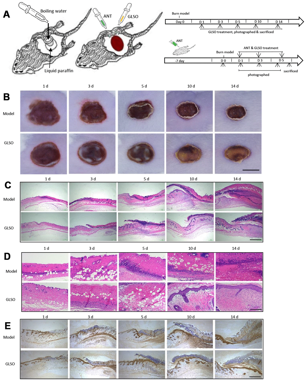 GLSO accelerates scald wound healing. (A) The experimental protocol of burn model and ANT treatment. (B) Gross examination of the wound area: a comparison of the model group with the GLSO group. Scale bar (B)=6 mm. (C, D) Images of H&E-stained tissue sections under the microscope 40X (C) and 200X (D) from the model group and GLSO group at different healing time points. Scale bar (C)=1 mm, scale bar(D)=200 μm. Immunohistochemical analysis of cytokeratin 14 under the microscope 40X (E) at the murine wound edge from the model group and GLSO group (scale bar=1 mm).