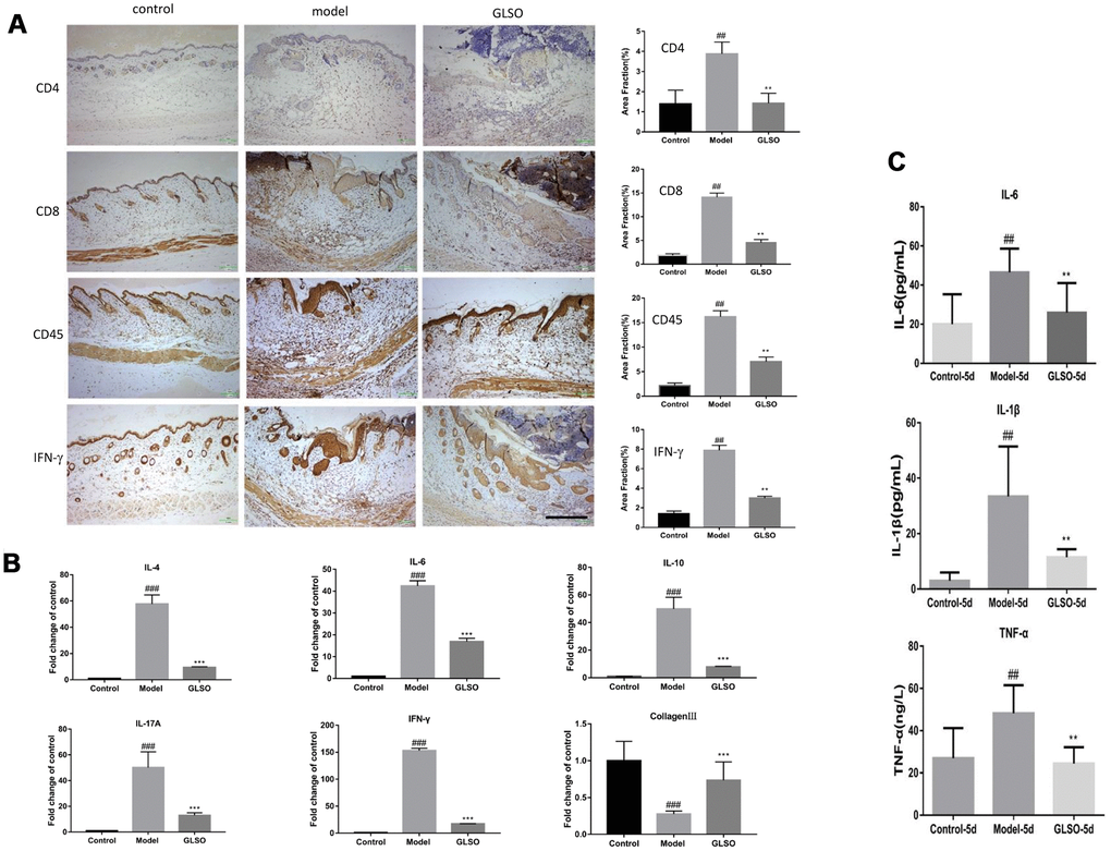 GLSO decreases the level of inflammation. (A) Immunohistochemical analysis of CD4, CD8 and CD45 at the murine wound edge on day 5 under the microscope 100X (scale bar=400 μm) was presented with quantitative analysis (n=3 each group). (B) The levels of inflammatory cytokines, IL-4, IL-10, IL-6, IL-17A and IFN-γ, were measured by real-time PCR. (C) The contents of IL-6, IL-1β and TNF-α were assayed by ELISA kit. The data are indicated as the mean±SD. ##P and **P ###P and ***P #P: control vs model, *P: GLSO vs model).