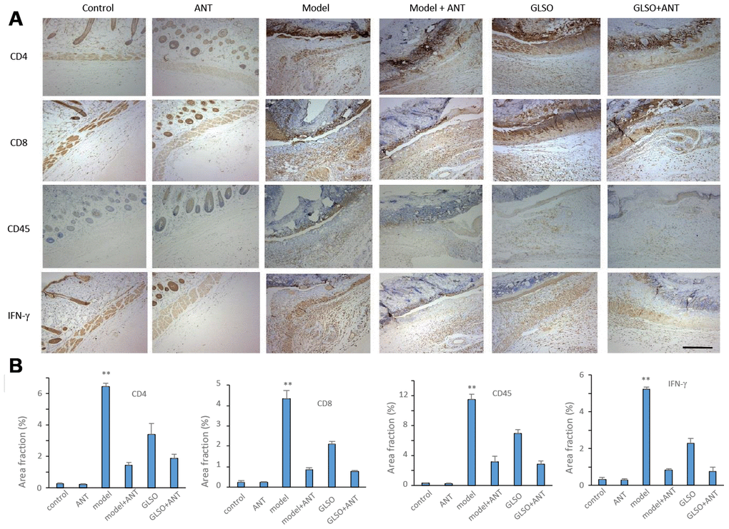 GLSO accelerates the skin wound healing through the transform from inflammation to proliferation phase. (A) Immunohistochemical analysis of relative inflammation cytokines under the microscope 100X. Scar bar=400μm. (B) Quantitative analysis of relative inflammation cytokines (n=3 each group). The data are indicated as the mean±SD. *P**P ***P *P: other groups vs model).