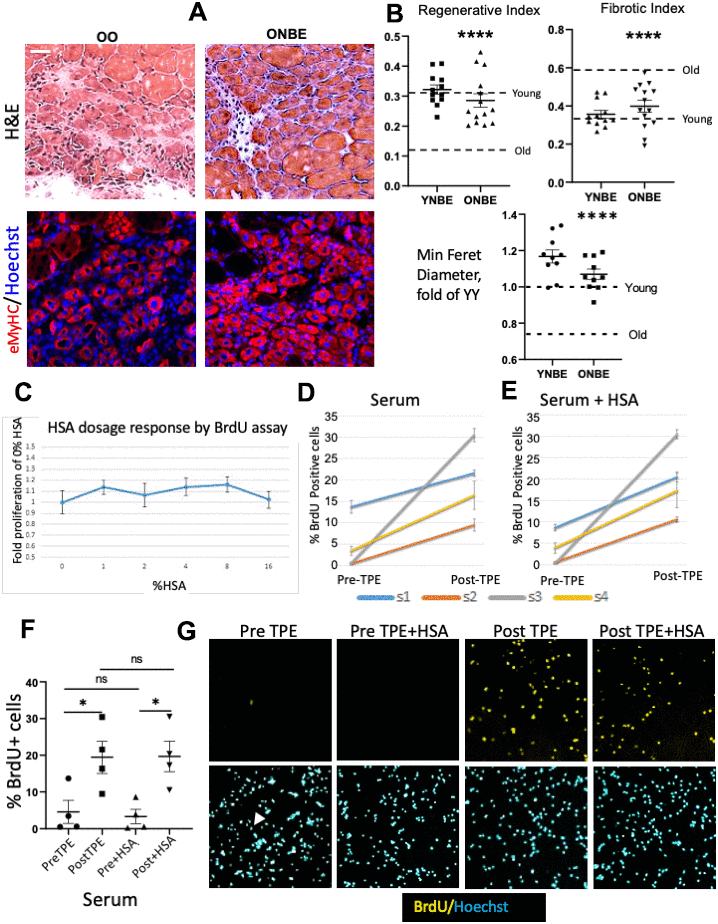 Rejuvenation of adult myogenesis, and albumin-independent effects of TPE. One day after the NBE, muscle was injured at two sites per TA by cardiotoxin; 5 days later muscle was isolated and cryosectioned at 10 μm. (A) Representative H&E and eMyHC IF images of the injury site. Scale bar = 50 μm. (B) Regenerative index: the number of centrally nucleated myofibers per total nuclei. OO vs. ONBE p = 0.000001, YY vs ONBE non-significant p = 0.4014; Fibrotic index: white devoid of myofibers areas. OO vs ONBE p = 0.000048, YY vs YNBE non-significant p = 0.1712. Minimal Feret diameter of eMyHC+ myofibers is normalized to the mean of YY [9]. OO vs. ONBE p= 3.04346E-05, YY vs. YNBE p=0.009. Data-points are TA injury sites of 4-5 YNBE and 5 ONBE animals. Young and Old levels (detailed in Supplementary Figure 1) are dashed lines. Representative images for YY versus YNBE cohorts are shown in Supplementary Figure 6. (C) Automated microscopy quantification of HSA dose response, as fold difference in BrdU+ cells from OPTI-MEM alone (0 HSA). There was no enhancement of myogenic proliferation at 1-16% HSA. N=6. (D) Meta-Express quantification of BrdU+ cells by automated high throughput microscopy for myoblasts cultured with 4% PreTPE versus PostTPE serum and (E) for these cells cultured with 4% of each: PreTPE serum + HSA or PostTPE serum + HSA. Significant increase in BrdU positive cells is detected in every subject 1, 2, 3, and 4 for TPE-treated serum (p=0.011, F) Scatter plot with Means and SEM of all Pre-TPE, Post-TPE, +/- HSA cohorts shows significant improvement in proliferation in Pre TPE as compared to and Post TPE cohorts (p*=0.033), as well as Pre+HSA and Post+HSA cohorts (p*=0.0116). In contrast, no significant change was observed when comparing Pre with Pre+HSA (p=0.744) or Post with Post+HSA (p=0.9733). N=4 subjects X 6 independent assays for each, at each condition. (G) Representative BrdU IF and Hoechst staining in sub-regions of one of the 9 sites that were captured by the automated microscopy. Blood serum from old individuals diminished myogenic cell proliferation with very few BrdU+ cells being visible (illustrated by one positive cell in Pre-TPE and arrowhead pointing to the corresponding nucleus); TPE abrogated this inhibition but HSA did not have a discernable effect.