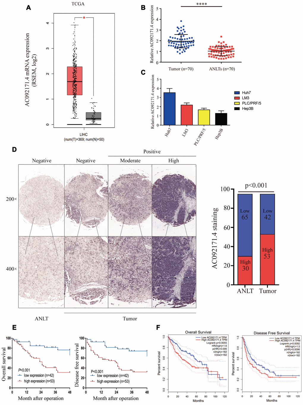 AC092171.4 is upregulated in HCC tissues. (A) Quantitative real-time PCR (qRT-PCR) analysis of AC092171.4 expression in HCC (n=369) and normal liver (n=50) tissues from the GEPIA database. As shown, AC092171.4 levels are higher in HCC tissues compared to normal liver tissues (*p). (B) QRT-PCR analysis of AC092171.4 expression in 70 pairs of HCC and corresponding ANLTs. As shown, AC092171.4 levels are higher in HCC tissues compared to adjacent normal liver tissues (ANLTs; ****p). (C) QRT-PCR analysis showing AC092171.4 expression was significantly higher in the Huh7 and LM3 HCC cell lines than PLC/PRF/5 and Hep3B cells. (D) Chromogenic in situ hybridization (CISH) analysis of AC092171.4 expression in 95 pairs of HCC and ANLTs in a representative photograph. The results show that AC092171.4 expression is higher in HCC tissues compared to ANLTs (p). (E) Kaplan-Meier survival curve analyses of overall survival (OS) and disease-free survival (DFS) in HCC patients with low (n=42) and high (n=53) AC092171.4 expression. (F) Kaplan-Meier survival curve analyses of overall survival (OS) and disease-free survival (DFS) in high and low AC092171.4-expressing HCC patients of the GEPIA dataset (tumor=369, normal=50). * denotes p