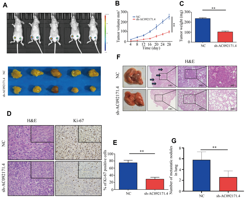 AC092171.4 knockdown represses in vivo xenograft HCC tumor growth and pulmonary metastases. (A) Balb/c nude mice were subcutaneously injected with sh-NC or sh-AC092171.4 transfected Huh7 cells and tumor from respective groups were shown (n=5). (B, C) Xenograft tumor volume and weights in nude mice subcutaneously injected with sh-NC or sh-AC092171.4 transfected Huh7 cells. (D, E) Immunohistochemical analysis shows percentage of Ki-67-positive stained cells in the sections of xenograft tumors from control and AC092171.4 knockdown nude mice. (F, G) Total numbers of pulmonary metastatic nodules in nude mice injected with control and AC092171.4 knockdown Huh-7 cells through the tail vein. * denotes p