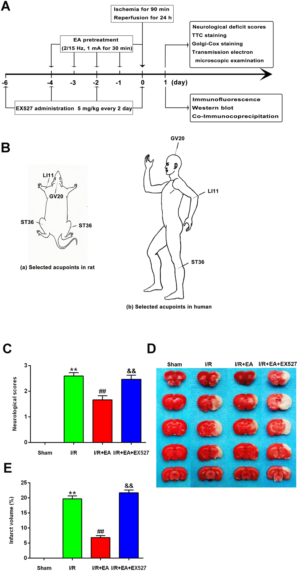 EA pretreatment ameliorated neurological deficits and reduced infarct volume in rats with CIR injury. (A) The schematic diagram illustrating the chronological events of experiments. (B) Rat schematic (a) and human schematic (b) showing the location of the EA acupoints selected in the present study. GV20 stands for “Baihui”, which is located at the right midpoint of the parietal bone. LI11 stands for “Quchi”, which is located in the depression lateral to the anterior aspect of the radial proximal elbow. ST36 stands for “Zusanli”, which is located in the posterolateral side of the knee joint, approximately 5 mm below the capitula fibula. (C) Neurological deficit scores (n=14). Neurological deficits were evaluated by Longa’s score. (D) Images of brain sections by TTC staining. (E) The ratio of infarct volume. Data were presented as mean ± SEM (n=3). **Pvs. sham group; ##Pvs. I/R group; &&Pvs. I/R + EA group.
