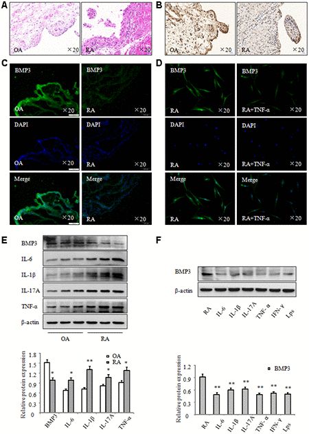 BMP3 expression was significantly downregulated in RA. (A) Representative H&E staining of OA and RA synovial tissues (original magnification, ×20). (B) BMP3 expression in OA and RA synovial tissues was analyzed using IHC staining (original magnification, ×20). (C) BMP3 expression in OA and RA synovial tissues was analyzed using immunofluorescence staining (original magnification, ×20). (D) BMP3 expression in RA FLS treated with TNF-α was analyzed using immunofluorescence staining (original magnification, ×10). (E) The protein levels of BMP3 in OA and RA synovial tissues were analyzed using western blot. (F) The protein levels of BMP3 in RA FLS treated with various inflammation factors were analyzed using western blot. All values are expressed as the mean ± SD. *P **P 