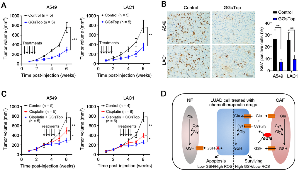 Targeting GGT5 inhibits tumor growth and enhances the drug sensitivity of LUAD cells in vivo. (A) Inhibiting GGT5 activity with a small-molecule inhibitor GGsTop (i.p. injection, 1 mg/kg) suppresses the tumor growth in nude mice xenograft model. (B) IHC staining with antibody against Ki67 (a marker of proliferative cell) in tissue sections from transplantation tumors treated with DMSO control or GGsTop. (C) Co-administration of Cisplatin (i.p. injection, 6 mg/kg) and GGsTop (i.p. injection, 1 mg/kg) significantly inhibits the tumor growth. (D) Schematic diagram for high level of GGT5 in CAFs contributing to LUAD cell survival and drug resistance by increasing intracellular GSH and decreasing the intracellular ROS level in tumor cells. In panels A and C, data represent mean ± SD, and in panel B, data represent mean ± SEM. In panels A-C, *, P P P 