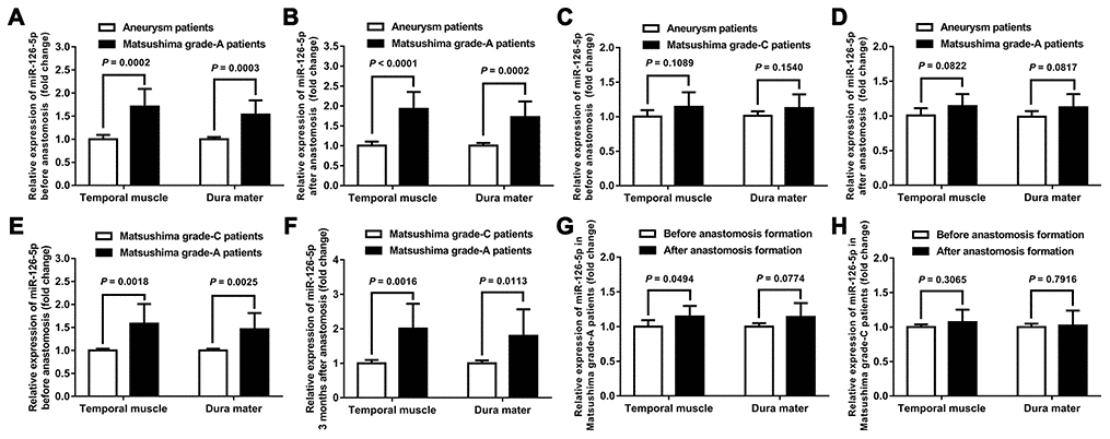 Expression of miR-126-5p in clinical samples. (A) Column chart showing the differences in miR-126-5p expression in the TM and DM samples between aneurysm patients (n = 8) and Matsushima grade-A patients (n = 8) before anastomosis formation. (B) Column chart showing the differences in miR-126-5p expression between aneurysm patients and Matsushima grade-A patients after anastomosis formation. (C) Column chart showing the differences in miR-126-5p expression between aneurysm patients and Matsushima grade-C patients (n = 8) before anastomosis formation. (D) Column chart showing the differences in miR-126-5p expression between aneurysm patients and Matsushima grade-C patients after anastomosis formation. (E) Column chart showing the differences in miR-126-5p expression between Matsushima grade-A patients and Matsushima grade-C patients before anastomosis formation. (F) Column chart showing the differences in miR-126-5p expression between Matsushima grade-A patients and Matsushima grade-C patients 3 months after anastomosis formation. (G) Column chart showing the differences in miR-126-5p expression in the TM and DM samples from Matsushima grade-A patients (n = 8) before and after anastomosis formation. (H) Column chart showing the differences in miR-126-5p expression in the TM and DM samples from Matsushima grade-C patients (n = 8) before and after anastomosis formation. The error bars represent the ±SDs. TM: temporal muscle; DM: dura mater.