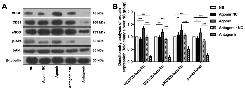 Western blot results showing the expression of relevant proteins in each group. (A) Representative western blot showing the expression of VEGF, CD31, eNOS and p-Akt in the ischemic brain tissue adjacent to the TM in each group (normalized to β-tubulin expression). (B) Densitometry analyses of VEGF, CD31, eNOS and p-Akt expression normalized to the expression of β-tubulin and t-Akt. The error bars represent the ±SDs. *P 