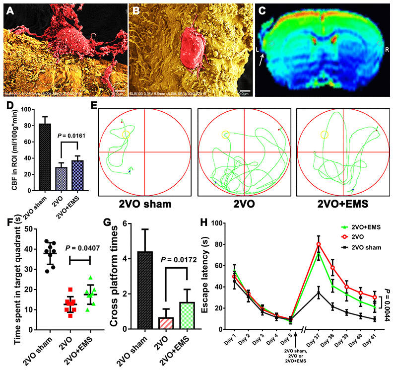Effectiveness of the 2VO+EMS model in improving CBP and cognitive function as determined by SEM, MRI-ASL and the MWM test. SEM observations showed that the pericytes (A) in the brain cortex on the EMS side exhibited increased activity and function than those (B) on the non-EMS side. Bar = 10 μm. (C) MRI-ASL images showing a higher CBF on the EMS side than on the non-EMS side (the white arrow indicates the EMS). (D) Column chart showing the CBF in the 2VO sham, 2VO and 2VO+EMS groups. (E–H) The MWM test results indicated that the improvement in cognitive function observed in the 2VO+EMS group was better than that found in the 2VO group (the 2VO sham group was used as the control). The error bars represent the ±SDs. SEM: scanning electron microscopy; ASL: arterial spin labeling; MWM: Morris water maze; ASL: arterial spin labeling; EMS: encephalo-myo-synangiosis.