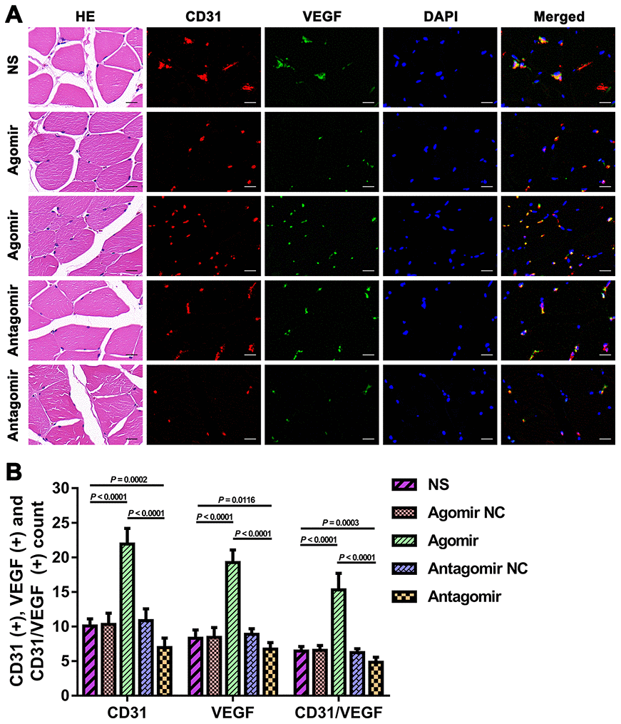 Expression of CD31 and VEGF in TM tissues from each group. (A) HE and immunofluorescence results showing CD31 and VEGF expression in TM tissues from each group. Bar = 20 μm. (B) Quantification of CD31(+), VEGF(+), and CD31/VEGF(+) cells in TM tissue. The data are reported as the means ± SDs. n = 8. VEGF: vascular endothelial growth factor.