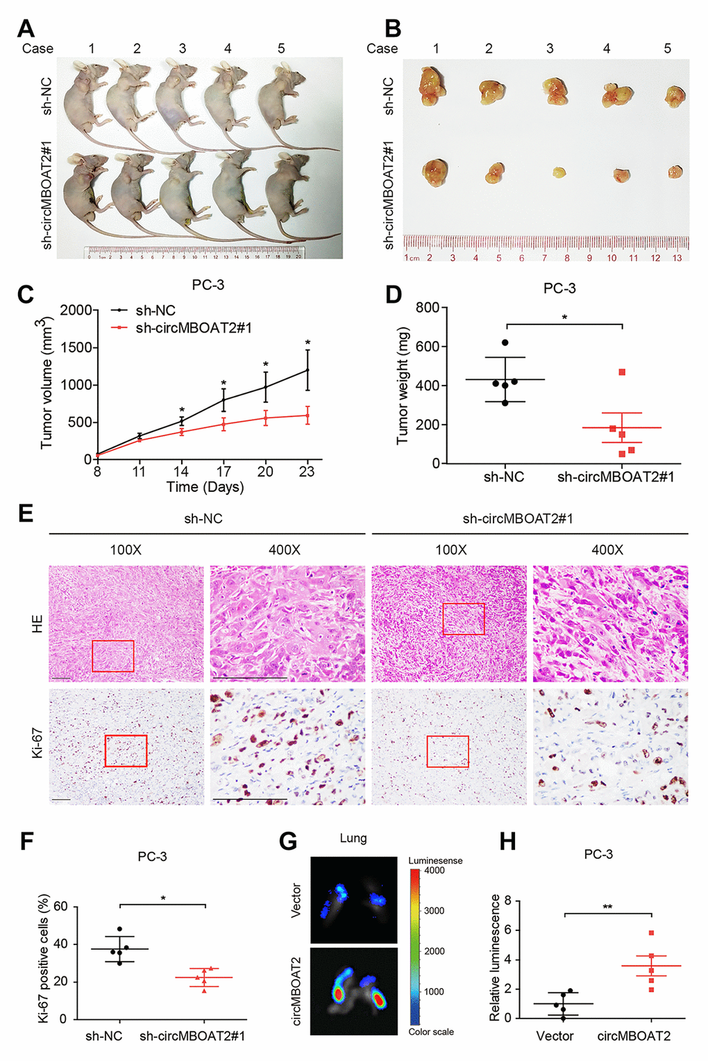 circMBOAT2 promotes tumorigenesis and metastasis in vivo. (A, B) Images of the xenograft subcutaneous models of PC-3 cells stably transfected with sh-circMBOAT2#1 or sh-NC. (C, D) Tumor volumes and weights of subcutaneous xenograft tumors. (E, F) Representative images of IHC staining and analysis of Ki-67 expression. Scale bars: 100 μm. (G, H) Representative bioluminescence images and analysis of excised lungs from xenograft metastatic models. Data are displayed as mean ± SD. *p p 