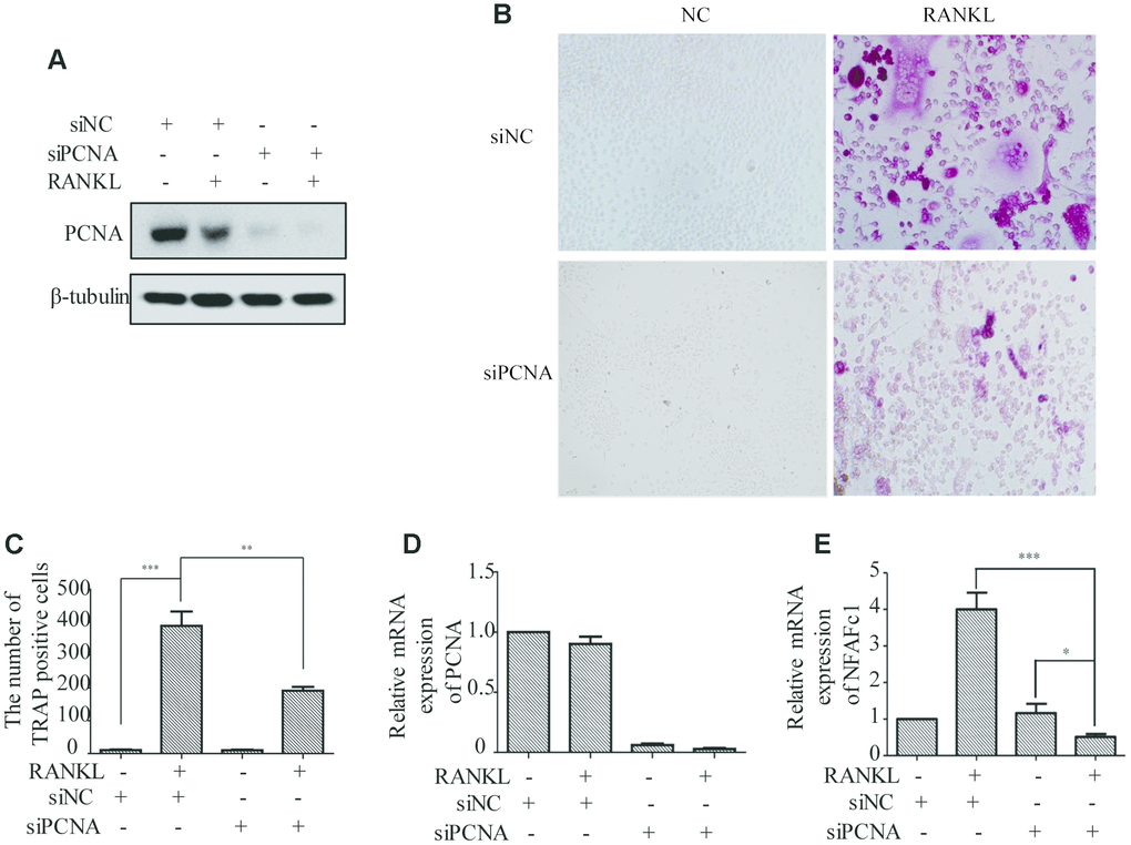 The effect of PCNA knockdown on RANKL-induced differentiation of osteoclast. (A) PCNA was successfully knocked down using its siRNA. RAW264.7 cells were transfected with siRNA targeting PCNA for 48 hours. Then, the cells were treated with RANKL (100 ng/mL) for 3 days and harvested for western blot assay using the indicated antibodies. (B) The effect of knockdown of PCNA on osteoclast differentiation. RAW264.7 cells were transfected with PCNA siRNA for 48 hours, then the cells were treated with RANKL for 3 days and stained with TRAP. (C) The number of TRAP-positive cells stained in (B). n=5, **: p D, E). *: p