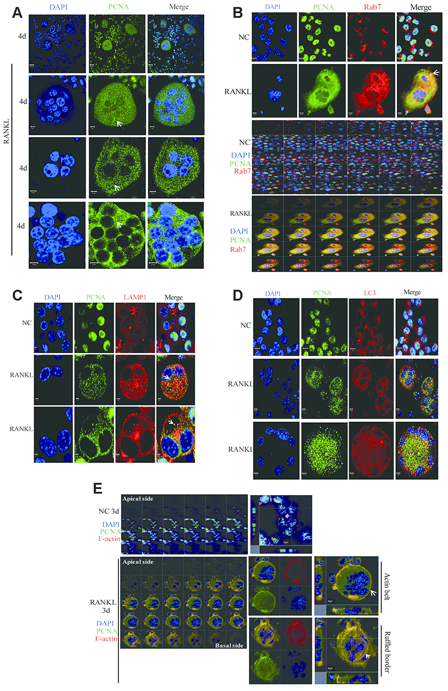 The co-localization of PCNA with Rab7 in RANKL-induced RAW264.7 cells. (A) IF assay was performed to localize PCNA in the 4-day RANKL-treated RAW264.7 cells using appropriate PCNA antibody. Arrows: PCNA located in the cytoplasm. Scar bar: 20μm for the top panel images and 5μm for the bottom three panels. (B) Co-localization of PCNA with Rab7 in RANKL-induced osteoclast. RAW264.7 cells were treated with RANKL (100 ng/mL) for 3 days and subjected to IF assays using PCNA and Rab7 antibodies. The Z-stack scan model of the LSM microscope was used to observe the cells from the abdominal end to dorsal end. All images were presented in order. Arrows: co-localization of PCNA with Rab7. Scar bar: 5μm for negative control (NC) cells and 10μm for RANKL treated cells. (C) Co-staining of PCNA with LAMP1 in RANKL-induced osteoclast as described in (B). Scar bar: 2μm. (D) Co-staining of PCNA with LC3 in RANKL-induced osteoclast as described in (B). Scar bar: 5μm. (E) Z-stack scan mode in confocal microscopy was used to detect the subcellular localization of PCNA and F-actin in the 3-day RANKL treated RAW264.7 cells. Upper panels: untreated negative control RAW264.7 cells; lower panels: 3-day RANKL treated RAW264.7 cells. Scar bar: 5μm.