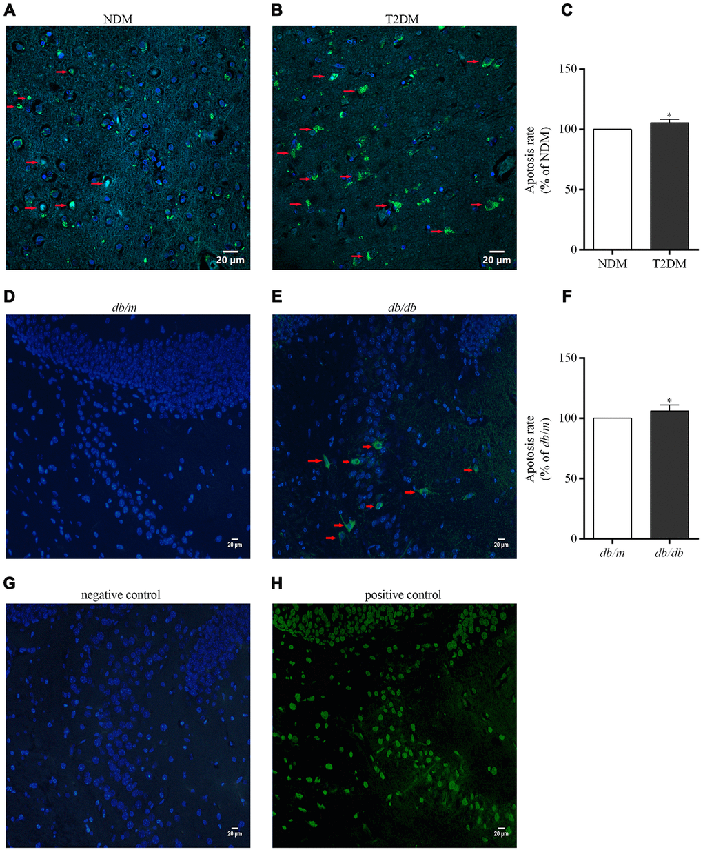 Apoptotic cells in the brains of the patients with T2DM and db/db mice as well as controls in situ detected with the TUNEL assay. Photographs were taken by using a laser confocal microscope (scale bars=20 μm). The co-localization of nuclei (DAPI, blue) and TUNEL-positive cells (green) indicated by red arrow are shown in the merged images. (A) NDM; (B) T2DM; (C) apoptosis rate of neurons in the human brains; (D) db/m mice; (E) db/db mice; (F) apoptosis rate of neurons in the mouse brains; (G) negative control for the method; (H) positive control for the method. The values presented as percentage of the control by relative quantification are mean ± SEM (n=5 for each group). *pC) or db/m mice (F) as determined by the two-tailed unpaired Student’s t test.