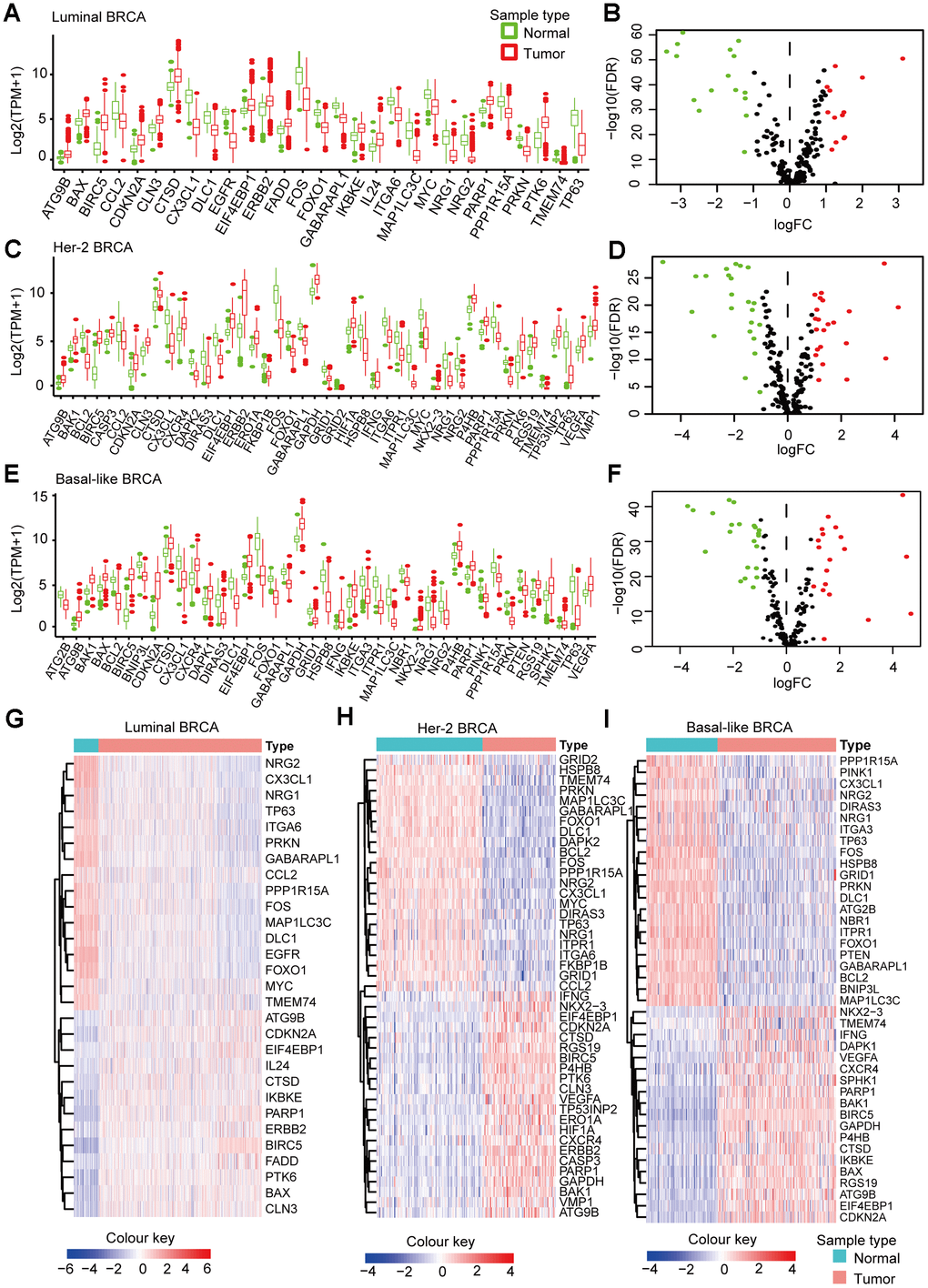 Subtype-specific DEARGs in BRCA and normal breast tissues. (A) Boxplot showing the expression pattern of DEARGs in Luminal BRCA. (B) Volcano plot for the 234 ARGs in Luminal BRCA. (C) Boxplot showing the expression pattern of DEARGs in Her-2 BRCA. (D) Volcano plot for the 234 ARGs in Her-2 BRCA. (E) Boxplot showing the expression pattern of DEARGs in Basal-like BRCA. (F) Volcano plot for the 234 ARGs in Basal-like BRCA. The upregulated, downregulated and no-differential expressed genes were indicated by green, red and black dots, respectively. The P-value was calculated by Wilcox-test. (G–I) Clustered heatmap of differentially expressed ARGs expression level in Luminal (G), Her-2 (H) and Basal-like (I) BRCA.