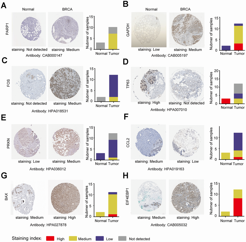 Analysis of the protein expression of ARGs in subtype-specific prognostic models by HPA. (A–H) The protein expression of PARP1, GAPDH, FOS, TP63, PRKN, CCL2, BAX and EIF4EBP were determined by immunohistochemistry using indicated antibodies in HPA database, the staining strengths were annotated as Not detected, Low, Medium and High. The bar plots indicating the number of samples with different staining strength in HPA database.