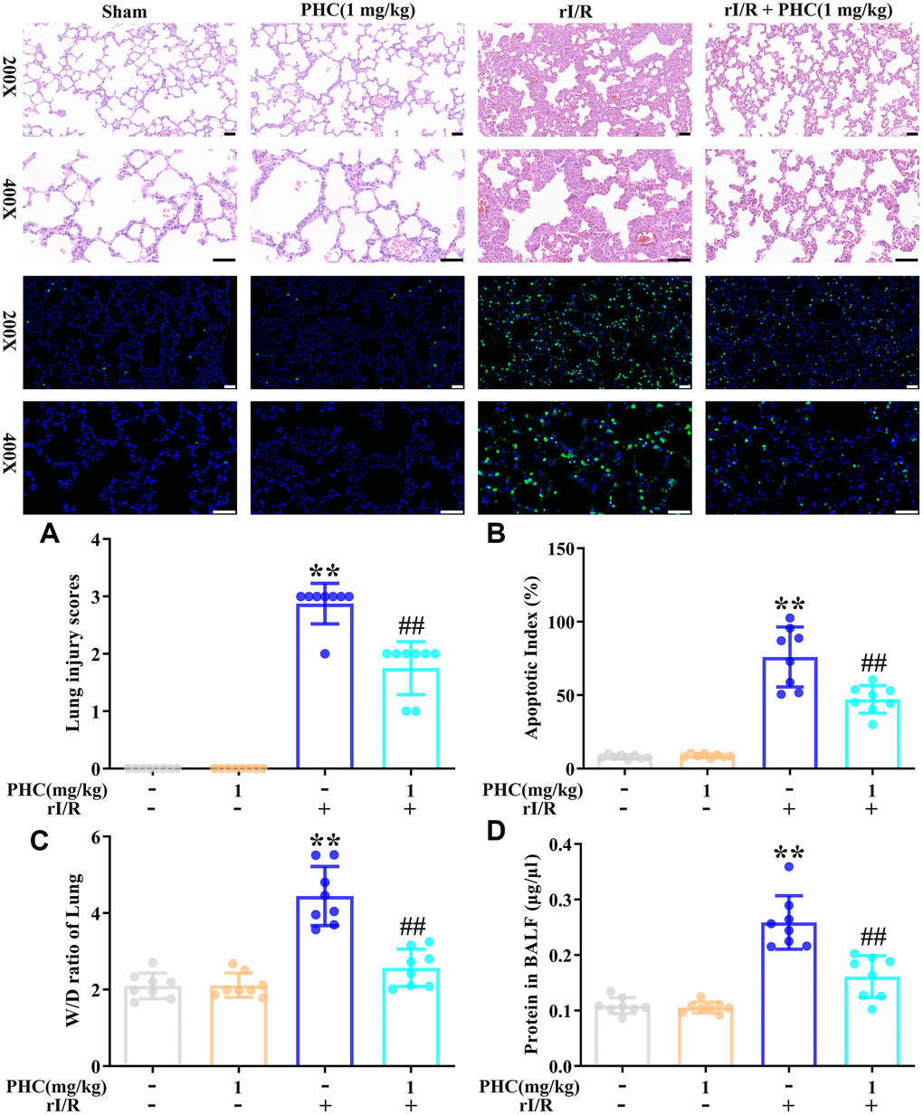 Effects of PHC on rI/R-induced lung inflammation in rats. (A) Twenty-four hours after rI/R treatment, lung sections from each investigational group (sham, PHC [1 mg/kg], rI/R, and rI/R + PHC [1 mg/kg]; n = 8) were obtained, sectioned, stained with H&E and assessed for apoptosis (original magnification 200×, 400×). A scale from 0 to 3 was used to calculate the mean lung injury score. (B) The relative apoptotic index (%) in the lungs was determined by TUNEL analysis. (C) The wet/dry weight ratios of the lungs were measured. (D) A BCA assay was used to determine the total protein level in BALF. Data are presented as the mean ± S.D. (n = 8, Scale bar: 50 μm). *P P #P ##P 