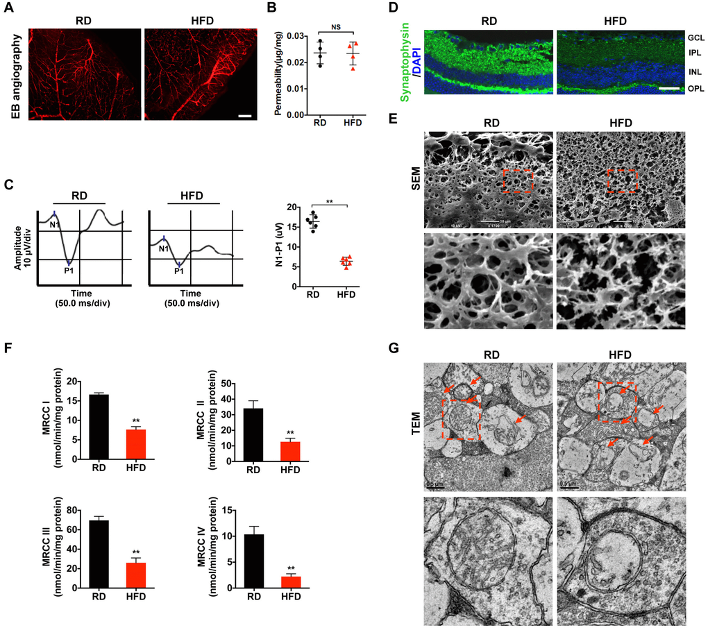 Mitochondrial impairment is associated with HFD-induced diabetic retinal neurodegeneration. (A) Representative images of retinal Evans Blue (EB) angiography from mice fed with regular chow (RD) or HFD for 20 weeks. Scale bar, 150 μm. (B) Retinal vascular leakage was quantified and normalized by total retinal protein concentrations, and expressed as μg of EB per mg of proteins. NS, no significant difference. (C) Representative waveforms of visual evoked potential (VEP). The differences in peak amplitude (N1-P1) were quantified. (D) Representative retinal immunofluorescence staining for synaptophysin (green). Nuclei were counterstained with DAPI (blue). Scale bar, 100 μm. GCL, ganglion cell layer; IPL, inner plexiform layer; INL, inner nuclear layer; OPL, outer plexiform layer. (E) Representative scanning electron microscopy (SEM) of retinal sections. Lower panels are high-power magnification of the areas indicated by the boxes. Scale bar, 10 μm. (F) Activities of retinal mitochondrial complex I-IV (MRCC I-IV) were measured by spectrophotometry and expressed as nmol/min/mg protein. Two retinae from 2 respective mice in the same group were pooled and preceded for each experiment. Three independent experiments were performed in duplicate for each group. (G) Representative transmission electron microscopy (TEM) of neural retinal sections. Mitochondria in IPL are indicated with arrows. Lower panels are high-power magnification of the areas indicated by the boxes. Scale bar, 0.5 μm. Data are means ± SEM. n = 4 (A, B) or n = 6 (C–G) mice per group. **P Supplementary Figure 1; Supplementary Figures 2A and 3A.