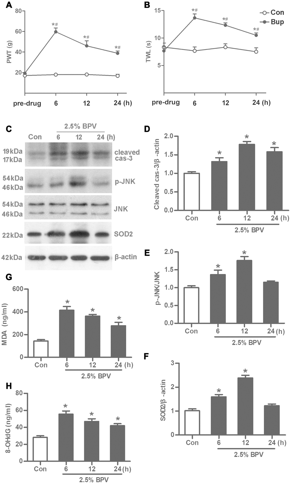 BPV caused spinal cord oxidative injury to activate JNK signaling and elevate SOD2 transcription in rats. Con: intrathecal injection of 0.9% saline with 0.2 μl/g in rats; BPV: intrathecal injection of 2.5% BPV with 0.2 μl/g in rats. (A, B) spinal reflex function in different times (6th h, 12th h or 24th h after intrathecal injection of 2.5% BPV or 0.9% saline with 0.2 μl/g) was investigated by PWT and TWL values; pre-drug: rats before intrathecal injection of 0.9% saline or 2.5% BPV; Values are the mean± SEM of n = 6; *: PPC–H) MDA and 8-OHdG production, JNK phosphorylation and SOD2 transcription were measured in spinal intumescentia lumbalis of rats in different times (6th h, 12th h or 24th h after intrathecal injection of BPV or saline); Values are the mean± SEM of n = 6; *: P