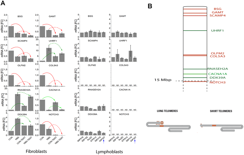 (A) mRNA expression of TPE-OLD candidate genes in cells with normal/short telomeres and artificially elongated telomeres in the presence of hTERT. qPCR analysis was performed in a healthy human fibroblast cell line, a NBS fibroblast cell line, and in all 6 available lymphoblastoid cell lines (LCLs). Total mRNA was extracted from proliferating fibroblasts and from the same cell lines proliferating with experimentally elongated telomeres, after immortalization with hTERT. In LCLs, mRNA from the 6 different donors was compared. One of these cell lines (94P307) showed extremely elongated telomeres on p19. The genes were identified as TPE-OLD candidates by use of Affymetrix gene chip experiments in independent cell lines from healthy controls and HGP patients (as described in Supplementary Tables 7–8 and Supplementary Figures 5–8). All values were normalized to the level (=1-fold) of mRNA in unmodified and pre-senescent control fibroblasts. Each assay was performed in triplicate. Red arrows mark the genes with attenuated regulation in NBS (short telomeres in pre-senescent vs. long telomeres in hTERT infected cells). Green arrows mark the genes with reversed regulation in NBS (dark green: downregulated in pre-senescence in controls; light green upregulated). The blue arrow marks the LCL with extremely long telomeres on 19p. BSG: basigin; GAMT: guanidinoacetate methyl-transferase; SCAMP4: secretory carrier membrane protein 4; OLFM1: olfactomedin 1; UHRF1: ubiquitin like with PHD and ring finger domains 1; COL5A3: collagen type V alpha 3 chain; RNASEH2A: ribonuclease H2 subunit A; CACNA1A: calcium voltage-gated channel subunit alpha1 A; DDX39A: DExD-box helicase 39A; NOTCH3: Notch receptor 3. ND, non detectable (mRNA quantifications with Ct values above 35). Borderline Ct values were detected for NOTCH3 for the LCL 95P182 (mean Ct = 34.9) and 59P319 (mean Ct = 34.6), not shown in the figure. (B) TPE-OLD concept. Telomeres loop to specific loci to regulate gene expression, a process termed telomere position effect over long distance [31]. The effect may likely extend to a distance of at least 10-15 Mbp from the telomere. The marked TPE-OLD gene candidates on 19p were investigated in experiments shown in Figure 5A: BSG, GAMT, SCAMP4, OLFM2, COL5A3, CACNA1A, NOTCH3 (upregulated in pre-senescent cells), and UHRF1, DDX39A and RNASEH2A (downregulated in senescent cells). TPE-OLD genes may form clusters with reverse regulation in NBS (green) further away from the telomere.