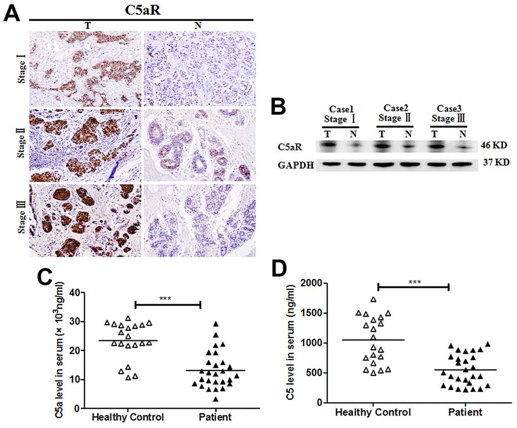 Enhanced C5aR expression in tumoral tissues of patients with BC. C5aR expression in BC tumoral tissues (T) and BC-adjacent non-tumoral tissues (N) was detected by (A) immunochemistry and (B) western blotting. (C) C5a and (D) C5 levels in serum were measured by enzyme-linked immunosorbent assay (ELISA) (healthy volunteers, n=20; BC patients, n=27). Magnification: 200×. The data are representative of three independent experiments. Data are presented as means ± SD. ***P