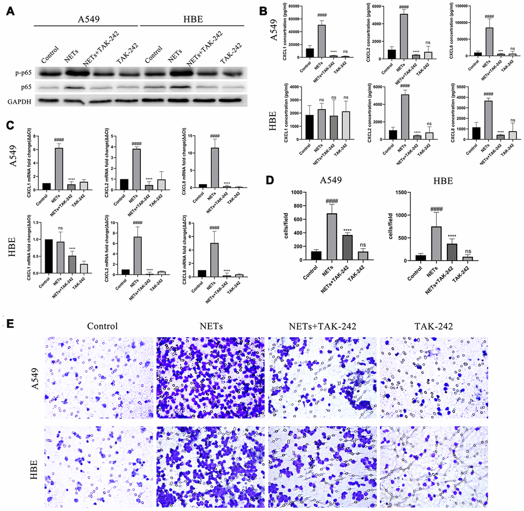 Inhibition of the TLR4/NF-κB pathway reduced chemokine expression and neutrophil migration in vitro after stimulation of HBEs and A549 by NETs. (A) After treatment of HBEs and A549 cells with TAK-242 and NETs simultaneously, p-p65 NF-κB and p65 NF-κB expression was measured by western blot. (B and C) After treatment of HBEs and A549 cells with TAK-242 and NETs simultaneously, CXCL1, CXCL2, and CXCL8 levels in the supernatant were analyzed by Luminex and RT-qPCR. (D and E) After treatment of HBEs and A549 cells with TAK-242 and NETs simultaneously, the supernatant was collected and added into the lower chamber. The neutrophils were then cultured in the upper chamber and neutrophil migration was analyzed by transwell after cell culture supernatant was induced for 48 h (200X). #: P