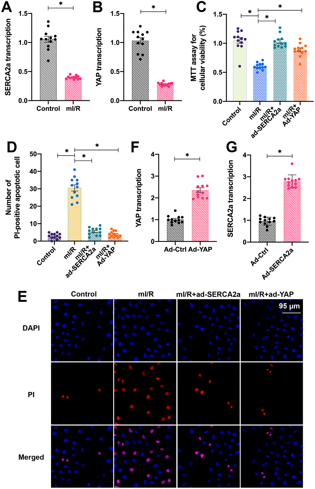 Overexpression of YAP or SERCA2a attenuates I/R-induced cardiomyocyte apoptosis. (A, B) Quantitative polymerase chain reaction (qPCR) assay was used to analyze the mRNA levels of YAP and SERCA2a in cardiomyocytes subjected to mI/R injury. SERCA2a adenovirus (ad-SERCA2a) and YAP adenovirus (ad-YAP) were transfected into cardiomyocytes to overexpress SERCA2a and YAP, respectively. (C) The MTT assay was used to detect the cardiomyocyte viability and (D, E) PI staining was used to assess the number (percentage) of apoptotic cells. (F, G) The qPCR assay was used to analyze the mRNA levels of YAP and SERCA2a in cardiomyocytes transfected with ad-SERCA2a or ad-YAP under physiological conditions. *P