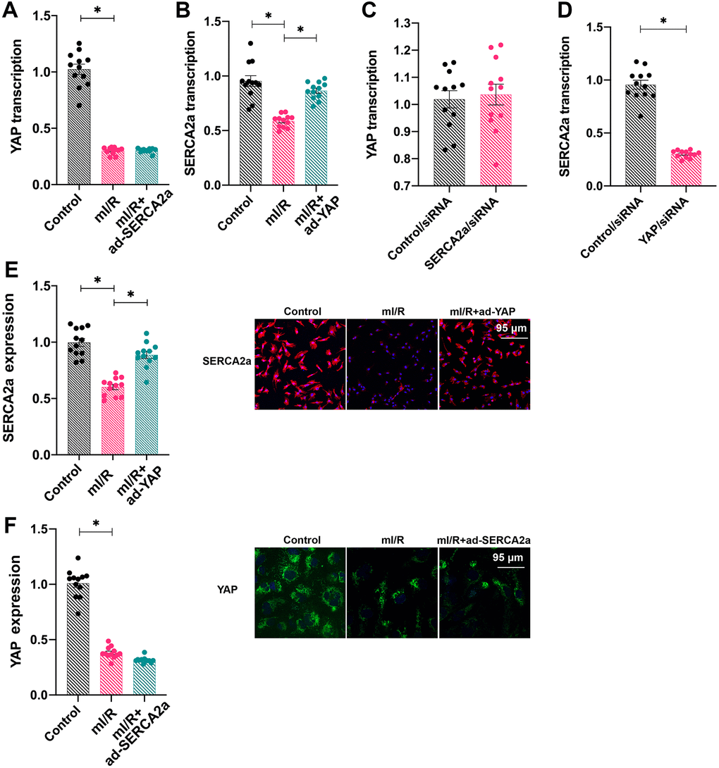 SERCA2a is transcriptionally regulated by YAP in cardiomyocytes. (A, B) Cardiomyocytes were transfected with ad-SERCA2a and ad-YAP to overexpress SERCA2a and YAP, respectively. Quantitative polymerase chain reaction (qPCR) assay was used to analyze the mRNA levels of YAP and SERCA2a in cardiomyocytes subjected to mI/R injury. (C, D) The qPCR assay was used to detect the mRNA levels of YAP and SERCA2a in cardiomyocytes transfected with SERCA2a siRNA or YAP siRNA. (E, F) Immunofluorescence assay was used to detect the expression of SERCA2a and YAP in cardiomyocytes subjected to mI/R using anti-SERCA2a (pink) and anti-YAP (green) antibodies, respectively. Scale bars, 95 μm. Left panels show quantification of the expression of SERCA2a and YAP.*P