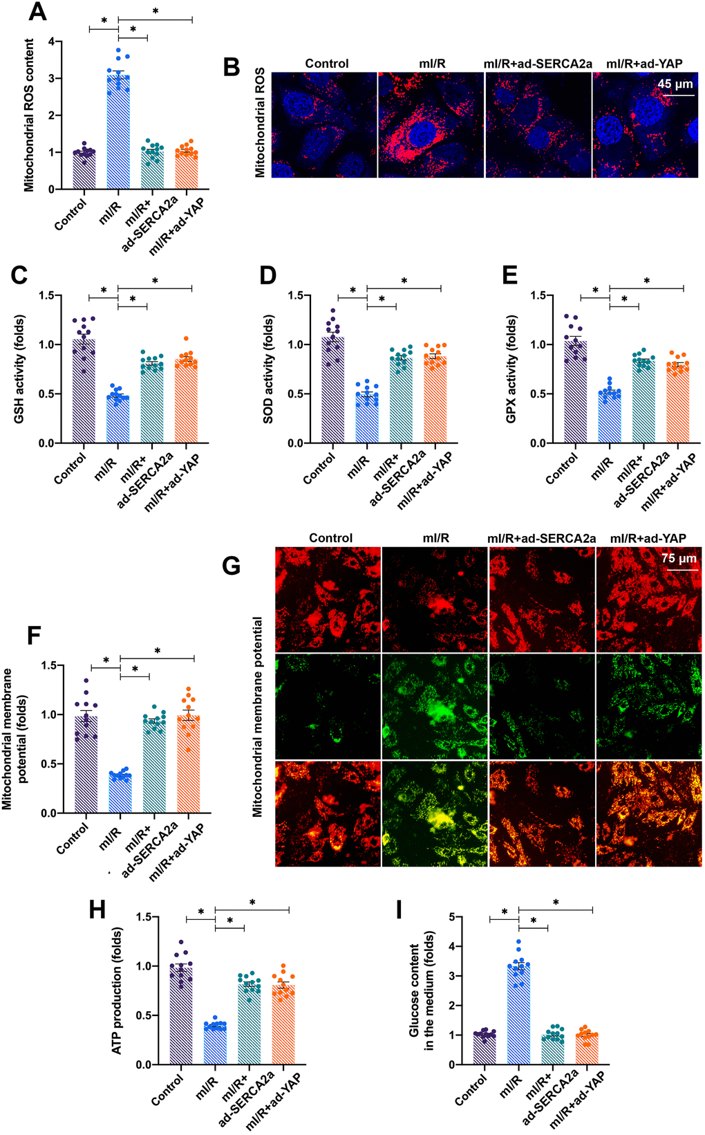 Activation of the YAP/SERCA2a pathway reduces mitochondrial damage in I/R-treated cardiomyocytes. (A, B) Immunofluorescence assay was used to detect the levels of mitochondrial ROS in cardiomyocytes transfected with ad-SERCA2a or ad-YAP in the presence of mI/R injury. (C–E) The activities of glutathione (GSH), superoxide dismutase (SOD), and glutathione peroxidase (GPx) were measured via enzyme-linked immunosorbent assay (ELISA) in cardiomyocytes transfected with ad-SERCA2a or ad-YAP in the presence of mI/R injury. (F, G) Mitochondrial membrane potential was measured using JC-1 staining. (H) ATP production was analyzed through ELISA. (I) The levels of glucose in the medium were determined by ELISA. *P