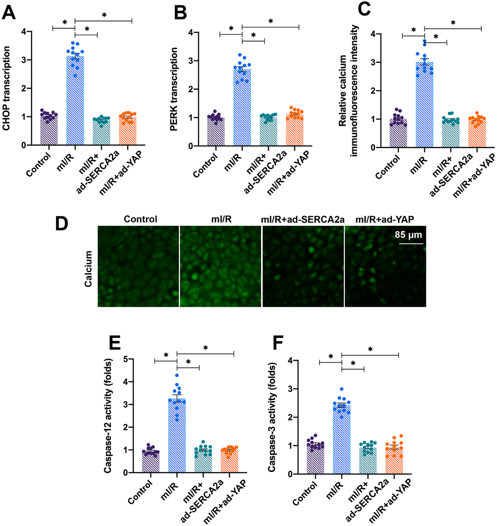 Activation of the YAP/SERCA2a pathway attenuates ERS in I/R-treated cardiomyocytes. (A, B) Cardiomyocytes were transfected with ad-SERCA2a and ad-YAP to overexpress SERCA2a and YAP, respectively. Quantitative polymerase chain reaction (qPCR) assay was used to analyze the mRNA levels of PERK and CHOP in cardiomyocytes transfected with ad-SERCA2a or ad-YAP in the presence of mI/R injury. (C) Quantification of relative calcium immunofluorescence intensity in cardiomyocytes transfected with ad-SERCA2a or ad-YAP in the presence of mI/R injury (D) Immunofluorescence assay was used to assess the baseline calcium overload in cardiomyocytes. (E, F) Enzyme-linked immunosorbent assay (ELISA) was used to detect the activation of caspase-12 and caspase-3. Scale bar, 85 μm.*P