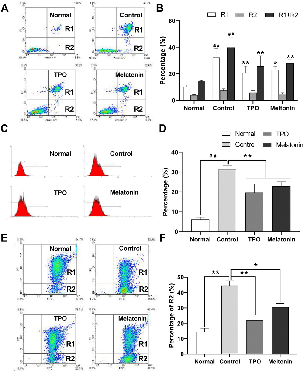 Melatonin significantly suppresses the apoptosis of nutrition-depleted CHRF cells. Cells were treated with saline (control), melatonin (200 nM) or TPO (positive control, 100 ng/mL) for 72 h. CHRF cells were harvested and subject to assays to measure the levels of (A) Annexin/PI (n=4), (C) activation of Caspase-3 (n=3) or (E) polarized mitochondrial membrane potential (JC-1, n=3). (B), (D, F) were the statistical analyses of (A, C, E), separately. Normal, CHRF cells incubated with 10% FBS; Control, CHRF cells incubated with 0.5% FBS. One-way ANOVA or Two-way ANOVA (with a Tukey multiple comparison test) was employed to test for significance. # # Compared with normal group, p