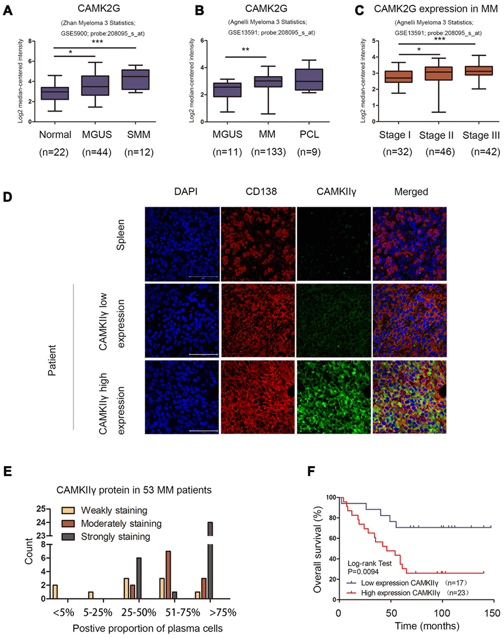 Overexpression of CAMKIIγ was associated with disease progression and poor prognosis of MM patients. (A, B) CAMK2G was differentially expressed in samples from healthy donors, monoclonal gammopathy of undetermined significance (MGUS), smoldering MM (SMM), MM, or PCL patients in the indicated datasets (*P P P C) The distribution of CAMK2G mRNA was at different stage of MM (*P P P D) CAMKIIγ protein expression was measured by immunofluorescent trichrome staining of DAPI (blue nuclear staining), plasma cell marker CD138 (red membrane staining) and CAMKIIγ (green cytoplasm staining). Representative images were shown at 630 X magnification. The white scale bar represented 50 μm. (E) The distribution of CAMKIIγ protein in 53 MM patients analyzed. (F) Kaplan-Meier overall survival curve for CAMKIIγ expression in 40 MM patients with extramedullary disease. Patients with high CAMKIIγ expression were significantly associated with poorer overall survival (P = 0.0094).