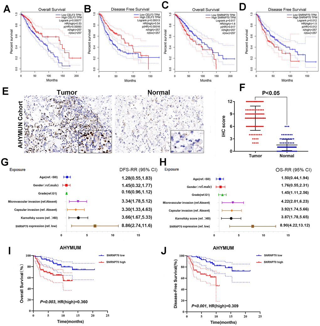 Further verification of SF gene and LGG prognosis. (A–D) OS and DFS of two example genes in LGG. CELF3 (A, B), SNRNP70 (C, D); (E) IHC on collected LGG tissue; (F) The scatter plot of the IHC scores(P G, H) Forest plots were used to visualize the univariate Cox regression analysis of DFS and OS in the AHYMUM cohorts. (I, J) Survival curves showed that LGG patients with elevated SNRNP70 expression levels in the AHYMUN cohort showed poorer OS (P = 0.003) and poorer DFS (P 