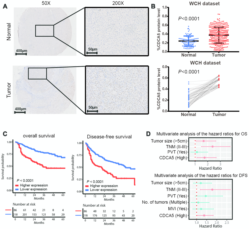 CDCA5 is upregulated in HCC tissues and predicts poorer survival outcomes. (A) Representative IHC staining of CDCA5 in HCC and paired normal tissues. (B) The relative protein level of CDCA5 is significantly higher in HCC tissues than in adjacent normal tissue (upper panel). Data represent the mean±SD. ***, pC) Higher expression of CDCA5 predicts poorer survival outcomes in patients with HCC. (D) Multivariable Cox regression analysis shows that CDCA5 is an independent risk factor for both OS (upper panel) and DFS (lower panel). Independent prognostic factors, including CDCA5 expression and other clinical parameters, were assessed using the multivariate Cox proportional hazards model among the variables found to be significant using univariate analysis. The HRs are presented as the means with 95% confidence interval. Differences with p