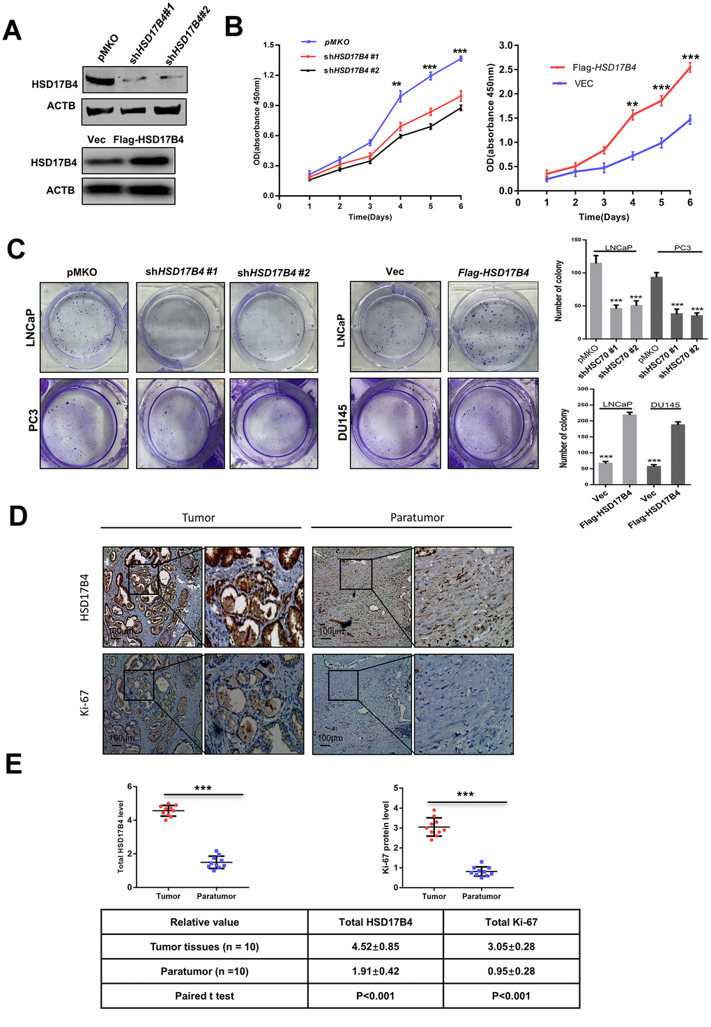 HSD17B4 promotes the proliferation of PCa cells. (A) Verification of LNCaP stable cell lines. The transfection efficiencies of shHSD17B4 and Flag-HSD17B4 were determined by western blotting. (B) HSD17B4 knockdown inhibited LNCaP cell growth, while HSD17B4 overexpression promoted cell growth. The CCK-8 assay showed that the growth of LNCaP cells characterized in (A) was affected by HSD17B4 knockdown or overexpression. The data shown are representative of three independent experiments. (C) HSD17B4 promotes the proliferation of PCa cells. PCa cells were transfected with shHSD17B4 or Flag-HSD17B4 plasmids as indicated and analyzed by a colony formation assay (left panel). Quantitative analysis of the colony was performed by ImageJ. **denotes P D–E) Immunohistochemical staining of Ki-67 and total HSD17B4 protein in tumor and adjacent tissues. Examples are shown in (D), and the statistical analysis of all samples is shown in (E). Scale bars: 100 μm. The intensities of the HSD17B4 and Ki-67 proteins in 10 PCa tissues (upper panel) and 10 adjacent normal prostate tissues (lower panel) were quantified, followed by statistical analysis. The mean value of multiple samples and the standard deviation are presented. Data are shown as the mean ± SD (n = 3) or typical photographs of one representative experiment. Similar results were obtained in three independent experiments. *p 