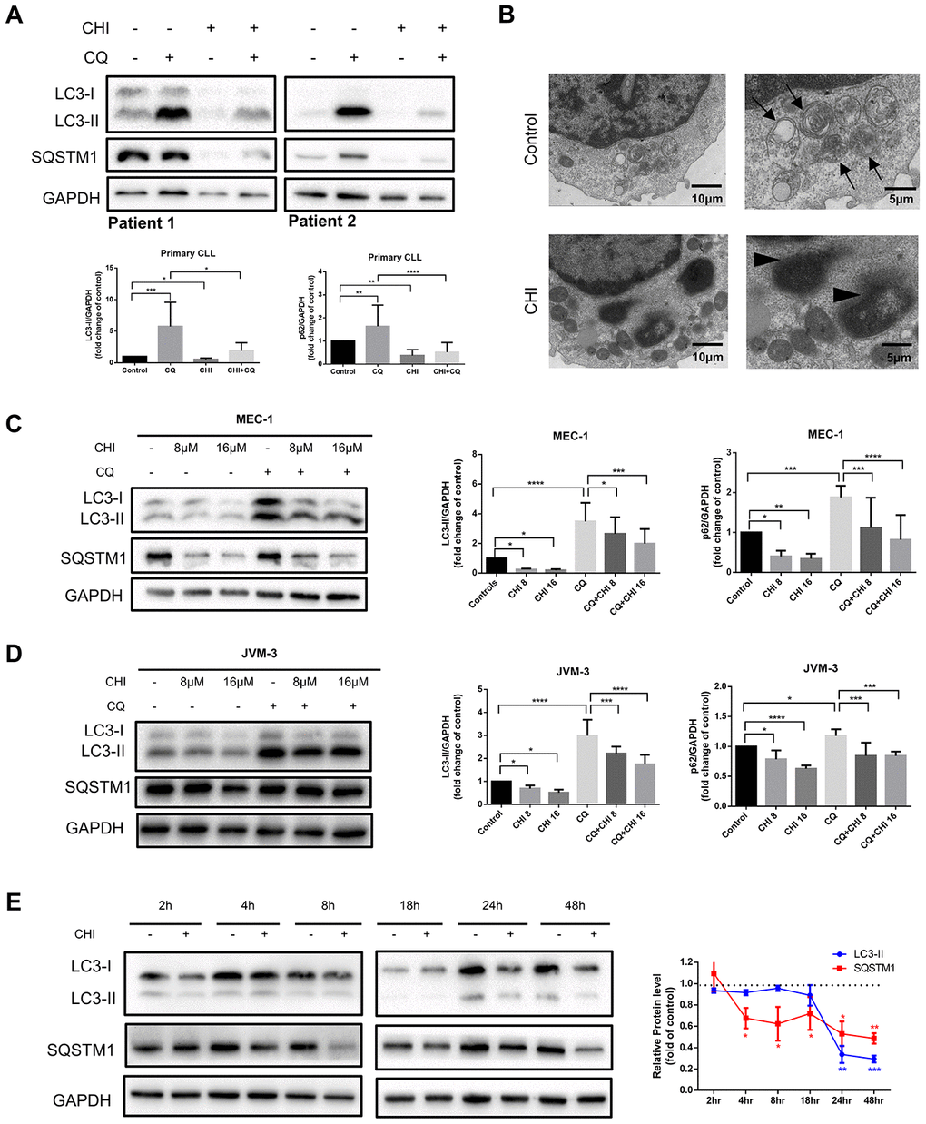 Chidamide decreases autophagic flux in CLL cells. (A) Immunoblotting analysis of autophagic flux in primary CLL cells after chidamide (CHI, 4μmol/L) treatment for 24 hours in the presence or absence of chloroquine (CQ, 10μmol/L). LC3 and SQSTM1 are indicated, as well as GAPDH that was used as a loading control. Shown are two representative blots from the samples of 16 patients. (B) Electron microscopic analysis of primary CLL cells in the presence or absence of chidamide (CHI, 4μmol/L) treatment for 24 hours. Arrows indicate autophagic structures and arrowheads indicate fragments of nucleus. (C, D) Immunoblotting analysis of autophagic flux in MEC-1 and JVM-3 cell lines respectively after chidamide (CHI, 8 or 16μmol/L) treatment for 24 hours in the presence or absence of chloroquine (CQ, 10μmol/L). (E) Levels of LC3 and SQSTM1 were assessed by immunoblotting in the presence or absence of chidamide (8μmol/L) in time-course experiments in MEC-1 cell line. GAPDH was used as a loading control. The bar graphs and the line graph showed the expression level of proteins with respect to the control groups. *P 