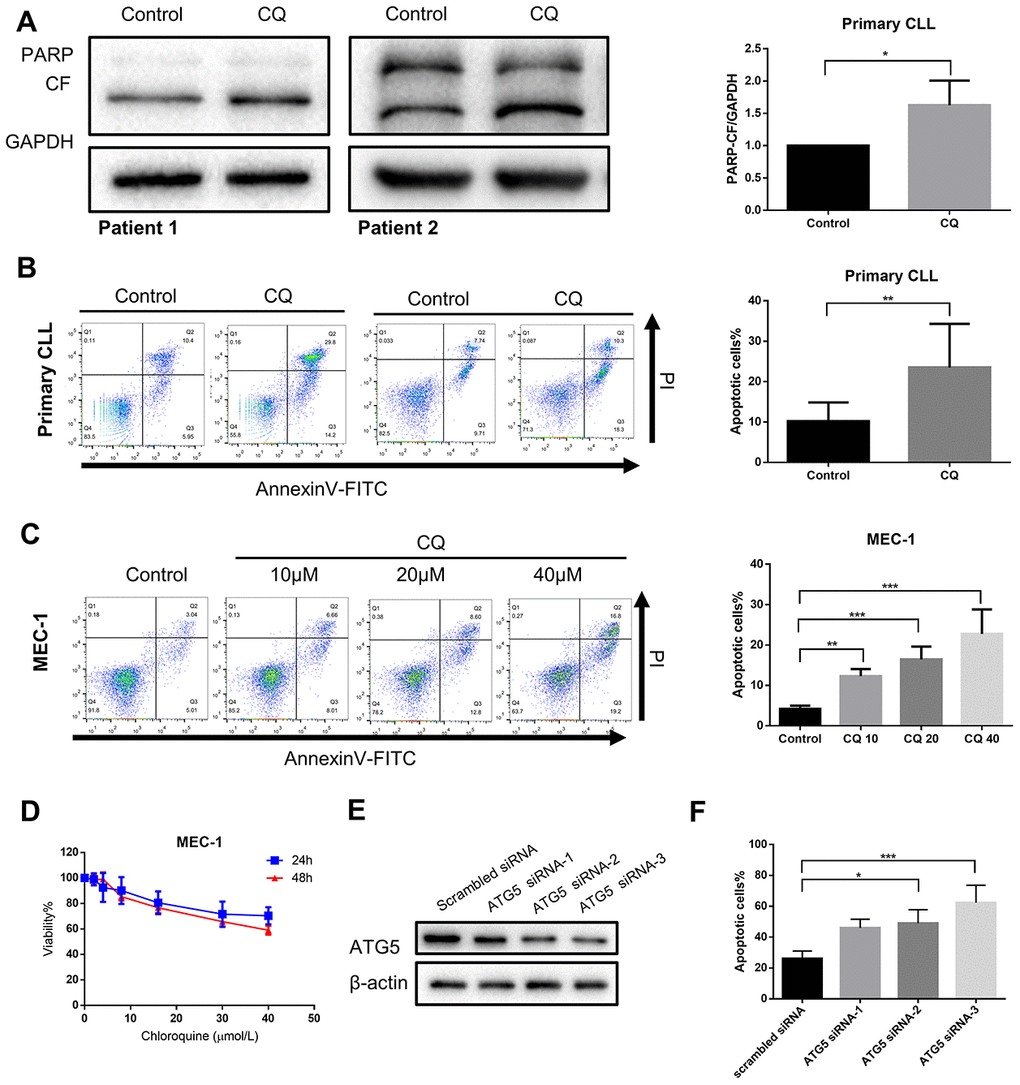 Inhibition of autophagy recapitulates the effect of chidamide. (A) Immunoblotting analysis of poly (ADP-ribose) polymerase (PARP) in primary CLL cells after chloroquine (CQ, 10μmol/L) treatment for 24 hours. Shown are 2 representative blots from the samples of 6 patients. The bar graph represents the relative PARP cleavage/GAPDH ratio measured by immunoblotting. (B, C) Flow cytometry using Annexin V–FITC/PI staining for cell apoptosis analysis. Primary CLL cells were incubated with 10μmol/L chloroquine for 24 hours while MEC-1 cell line were incubated with indicated concentrations of chidamide for 24 hours. Representative data shown are from 9 patients and three independent experiments of MEC-1. The bar graphs showed the percentage of apoptotic cells. (D) CCK8 assay for detecting metabolically active cells. MEC-1 cell lines was incubated with indicated concentrations of chloroquine for 24 and 48 hours. Viability of cells compared with the corresponding controls was shown from three independent experiments. (E, F) MEC-1 cells were transfected with ATG5 or nontargeting scrambled siRNA as indicated. Expression levels of targeted gene were analyzed by Immunoblotting. Percentage of apoptotic cells was assessed by flow cytometry following Annexin V-FITC/PI staining.