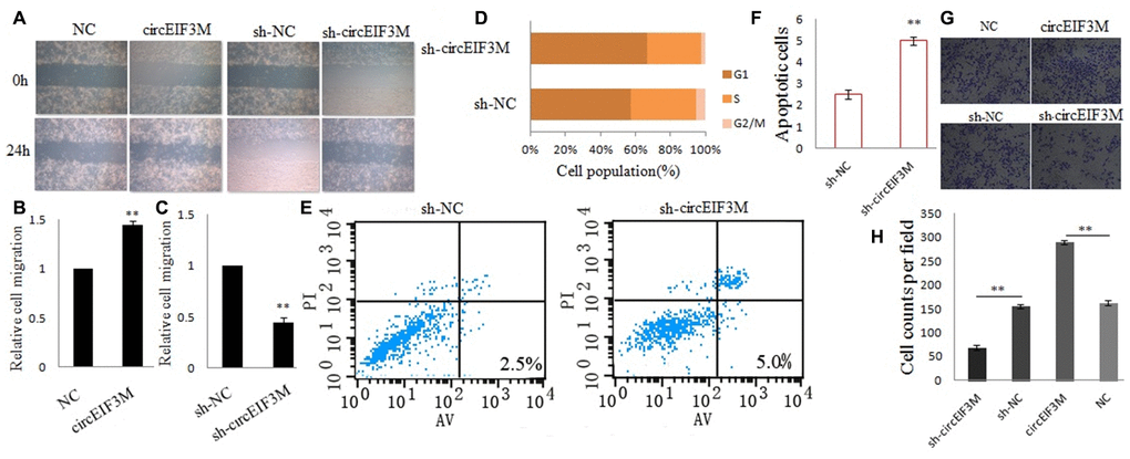 CircEIF3M promotes TNBC cell progression. (A–C) Cell migration capacities were detected by wound healing assays after transfected with indicated vectors (magnification, × 40, Scale bar, 200 μm.). (D) Cell cycle progression was analyzed by flow cytometry after transfected with indicated plasmids. (E and F) The apoptosis rate was analyzed by flow cytometry after downregulation of circEIF3M. (G and H) Cell invasion abilities were determined by transwell assays after transfection (magnification, × 100, scale bar, 100 μm). Data were showed as mean ± SD, **P 